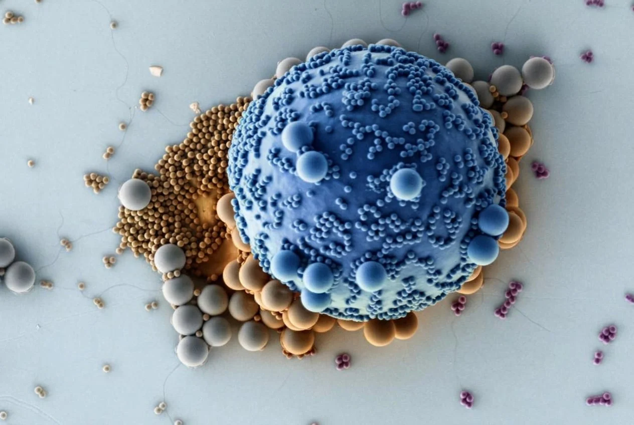 Micrografía coloreada de partículas de microplástico, diminutos fragmentos que pueden llegar al organismo a través del agua, los alimentos y el aire.