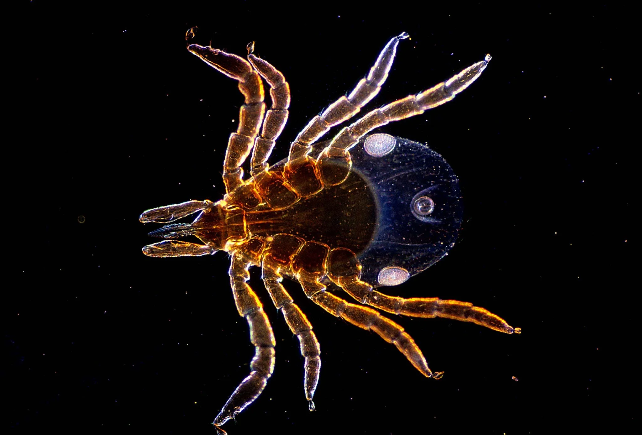 Ninfa de la garrapata. Algunas personas confunden su picadura con la de unos ácaros microscópicos inofensivos conocidos como chiggers.