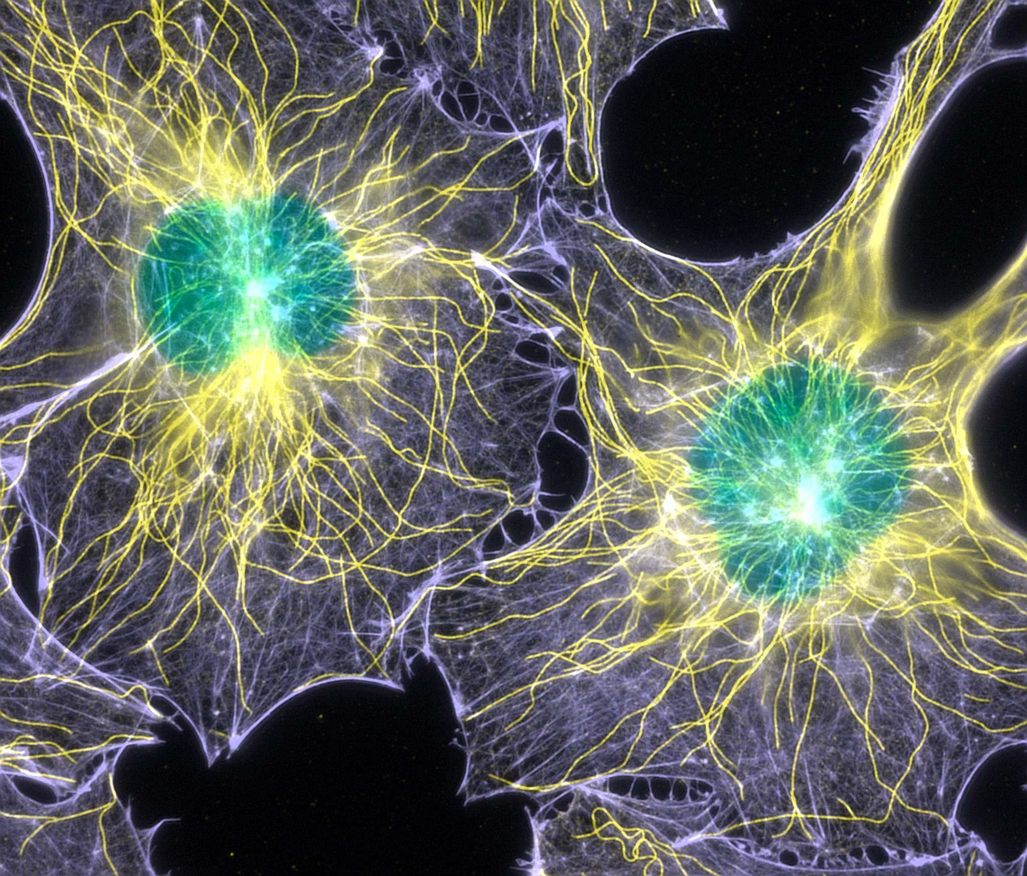 Red de actina (amarillo) y microtúbulos en fibroblastos de ratón, dos componentes clave del citoesqueleto que no solo dan forma a la célula, sino que también generan y guían los flujos internos que transportan proteínas hacia las zonas activas.
