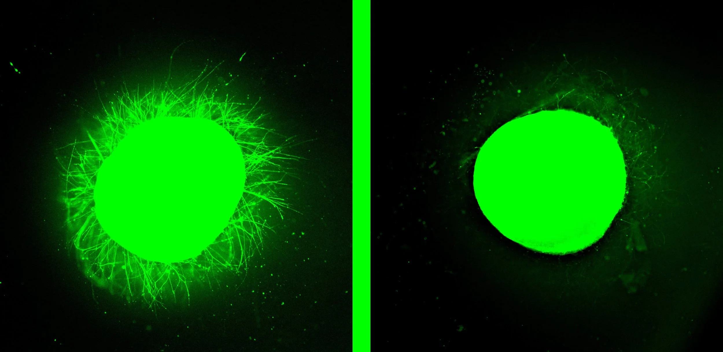 Estas micrografías fluorescentes muestran un mayor crecimiento de neuritas en un organoide de médula espinal humana tratado con moléculas danzantes de movimiento rápido (izquierda) frente a otro tratado con moléculas más lentas.