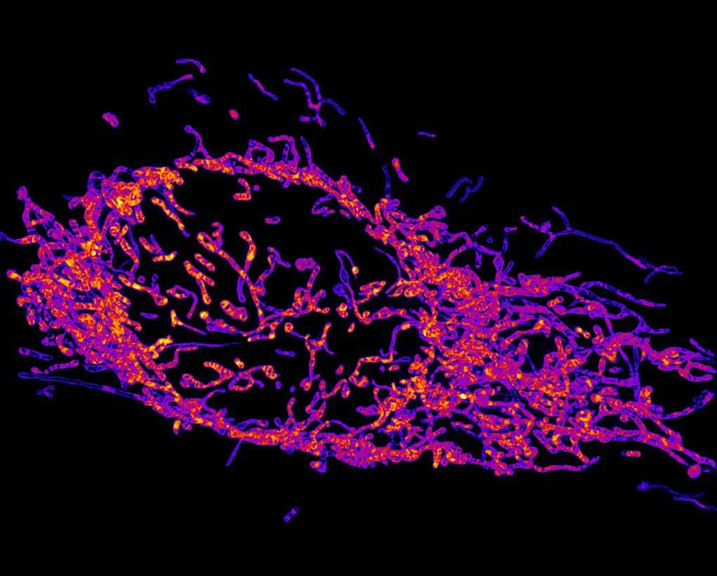 Mitocondrias (hilos de color) en una célula cancerosa.