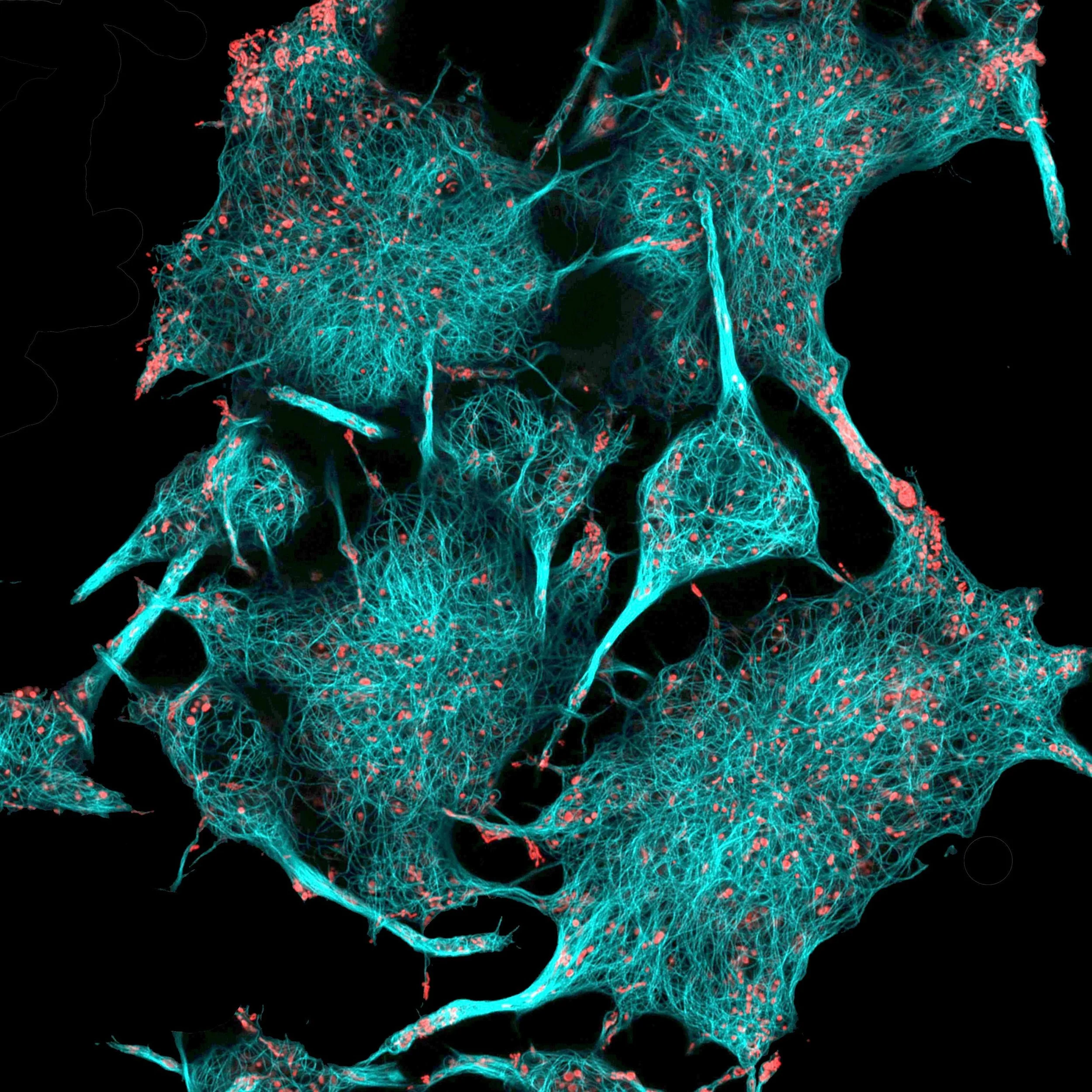 Células cerebrales de ratón con microtúbulos (en cian) y mitocondrias (en rojo), estructuras clave implicadas en la energía celular y en los procesos de envejecimiento cerebral que esta nueva terapia busca restaurar.