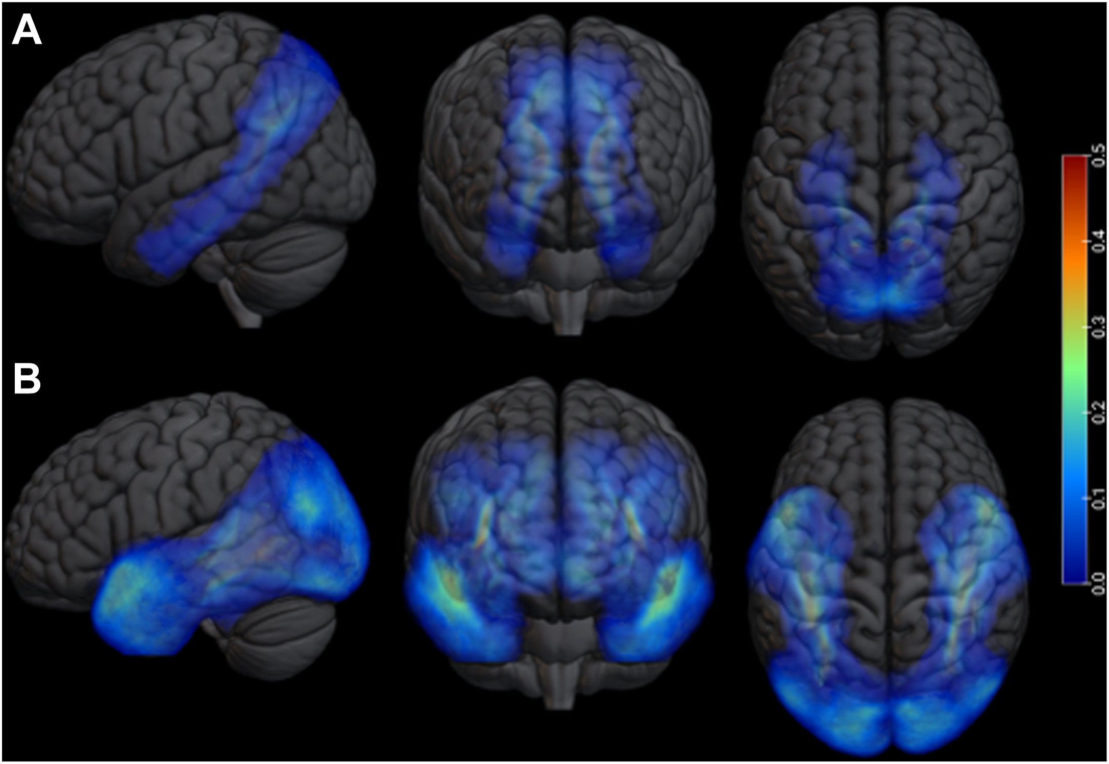 Mapas de densidad de las conexiones cerebrales analizadas en los participantes del estudio.