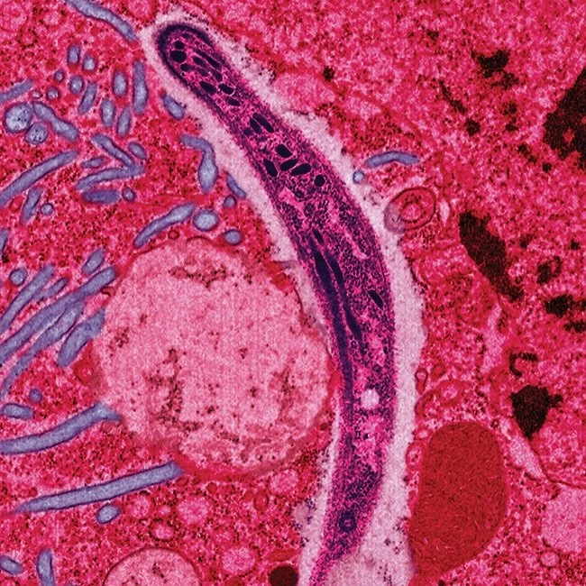 Micrografía electrónica coloreada de un esporozoíto de Plasmodium, el parásito causante de la malaria, mientras atraviesa el intestino de un mosquito Anopheles.