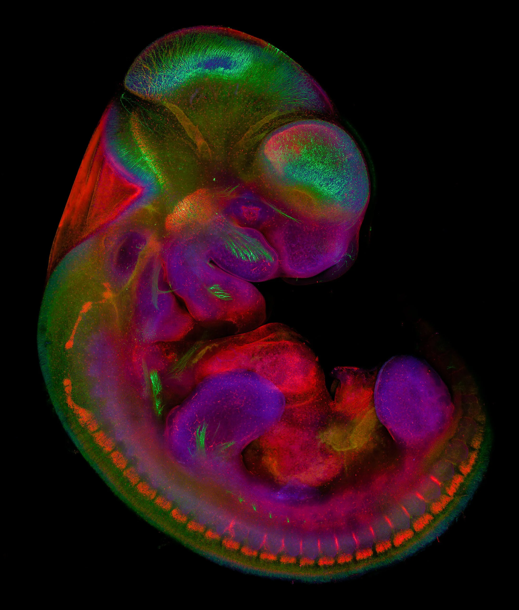 Embrión de ratón de 10,5 días observado mediante microscopía de fluorescencia. En esta etapa temprana, el cerebro y el resto del sistema nervioso experimentan una rápida diferenciación celular.