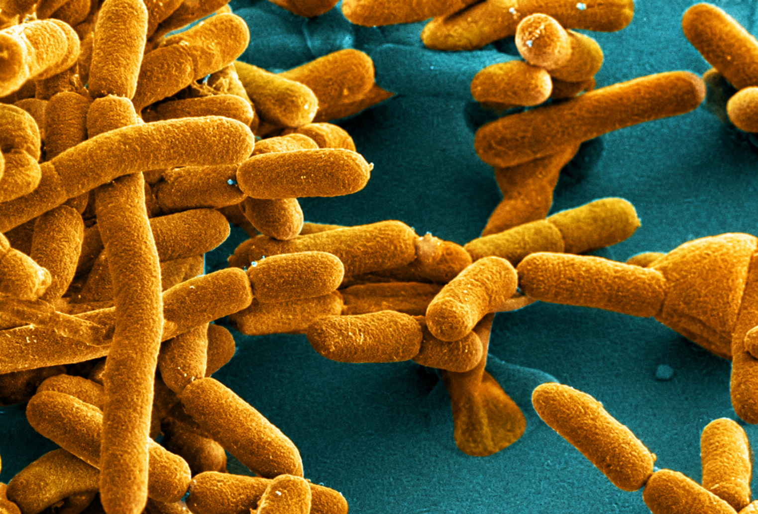 Micrografía coloreada de Faecalibacterium prausnitzii, una bacteria beneficiosa del microbioma intestinal cuya reposición mediante un probiótico experimental logró reducir la inflamación y el daño orgánico en un modelo animal de lupus.