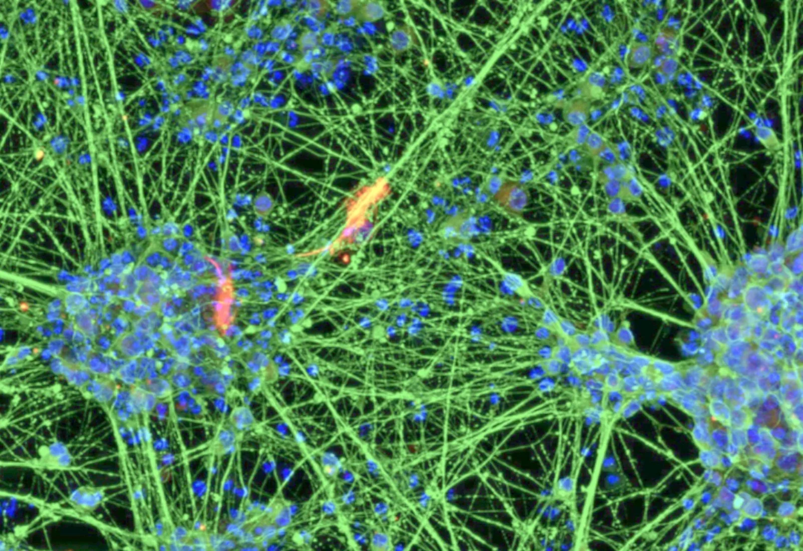 Neuronas obtenidas al diferenciar células madre neurales inducidas (iNSCs), generadas mediante la reprogramación de células sanguíneas.