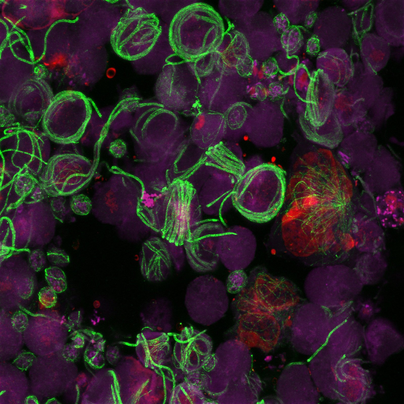 Micrografía de fluorescencia de parásitos de la malaria entre células sanguíneas de ratón.