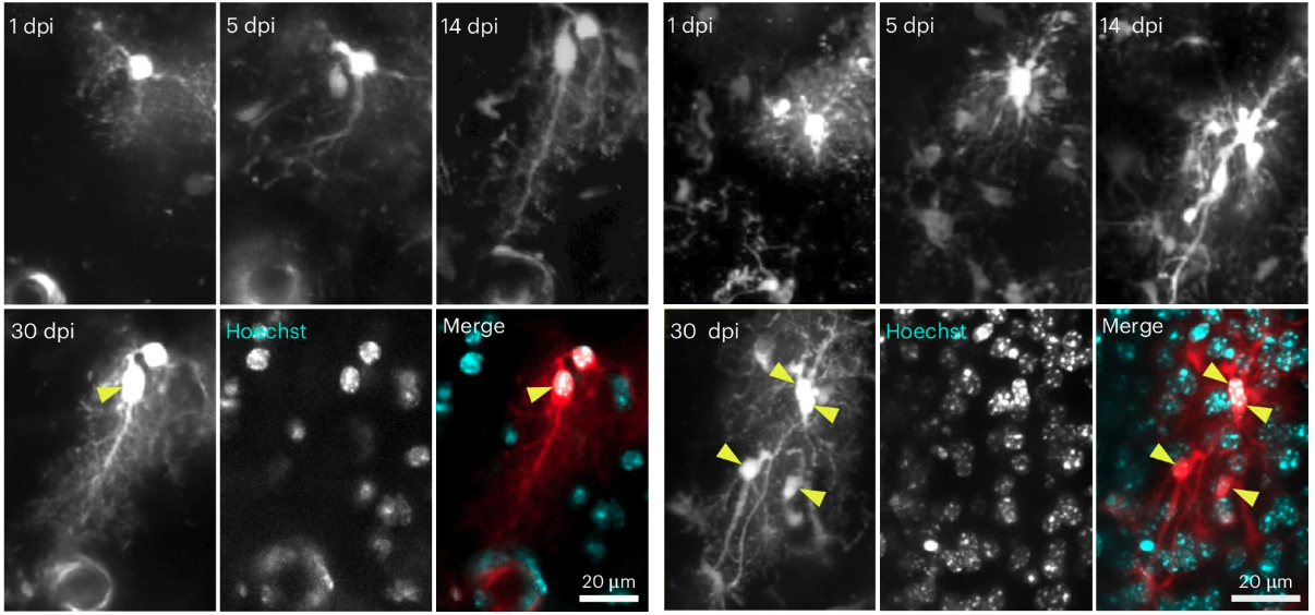 Seguimiento mediante microscopía de astrocitos individuales situados alrededor de una lesión cerebral a lo largo de 30 días.