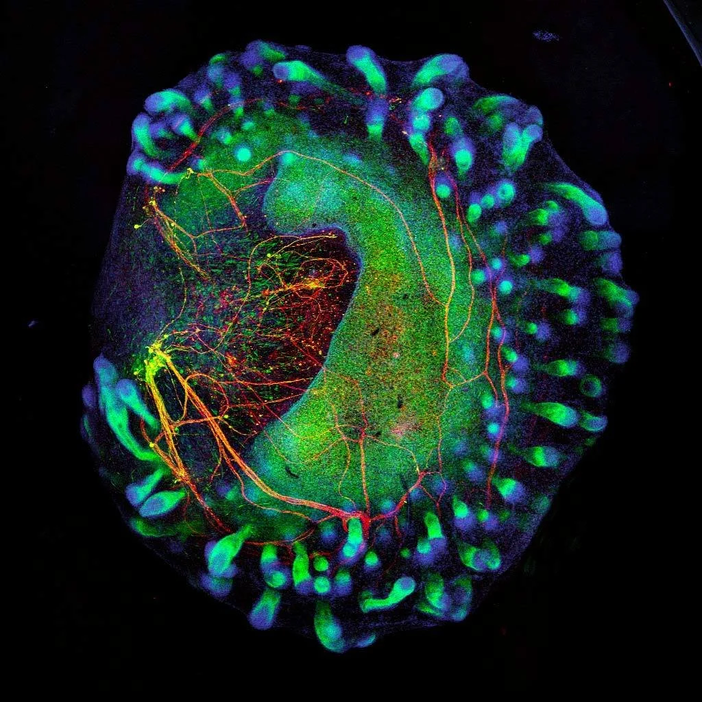 Organoide de piel humana con folículos pilosos, en verde, y neuronas sensoriales, en rojo, generado a partir de células madre.