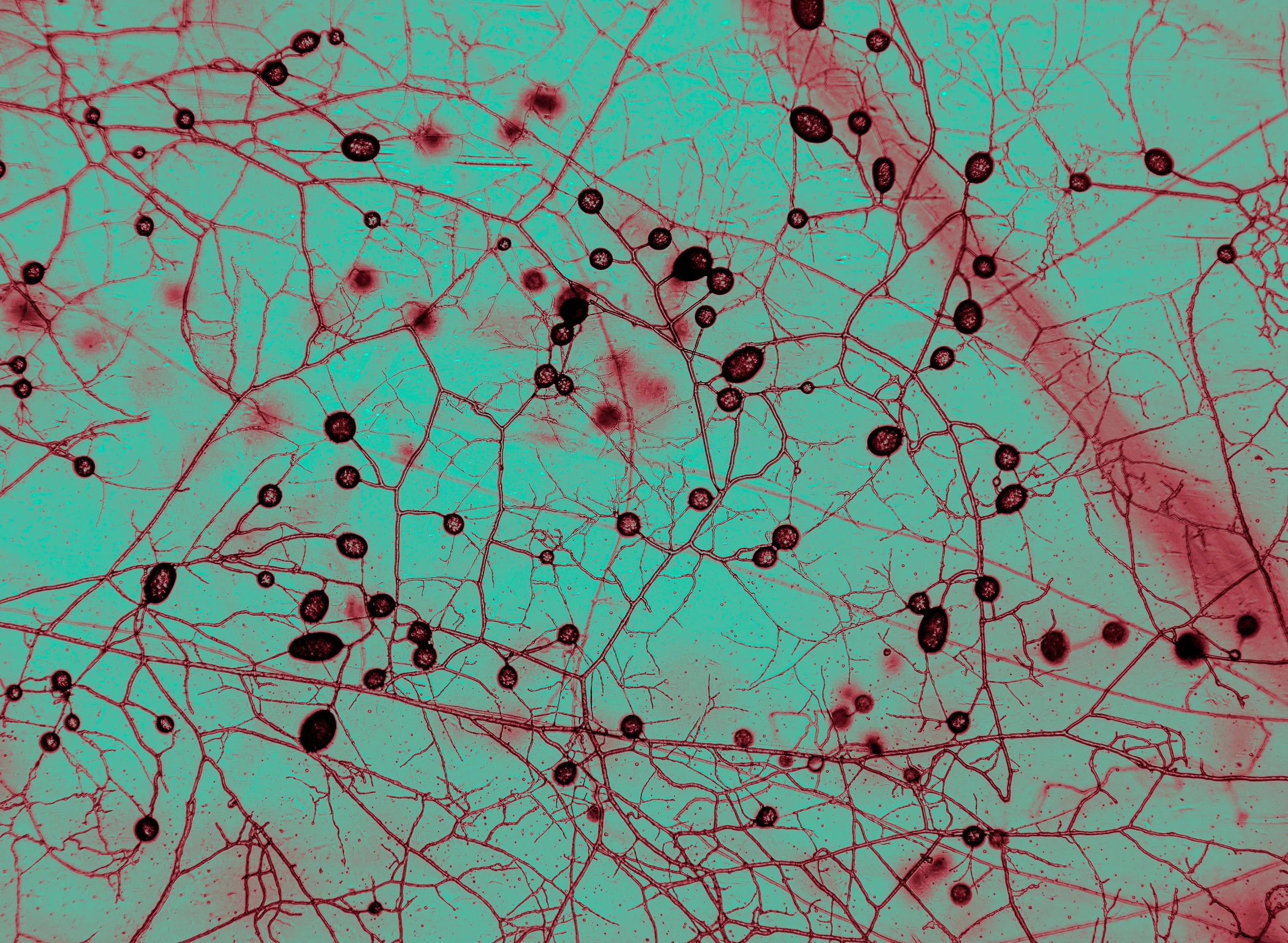 Imagen microscópica de una red de hongos micorrízicos, cuyos filamentos se extienden por el suelo formando complejas conexiones con las raíces de las plantas.
