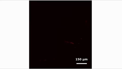 La microscopía Raman recorre una muestra de tejido cutáneo mediante distintas longitudes de onda de la luz dispersada.