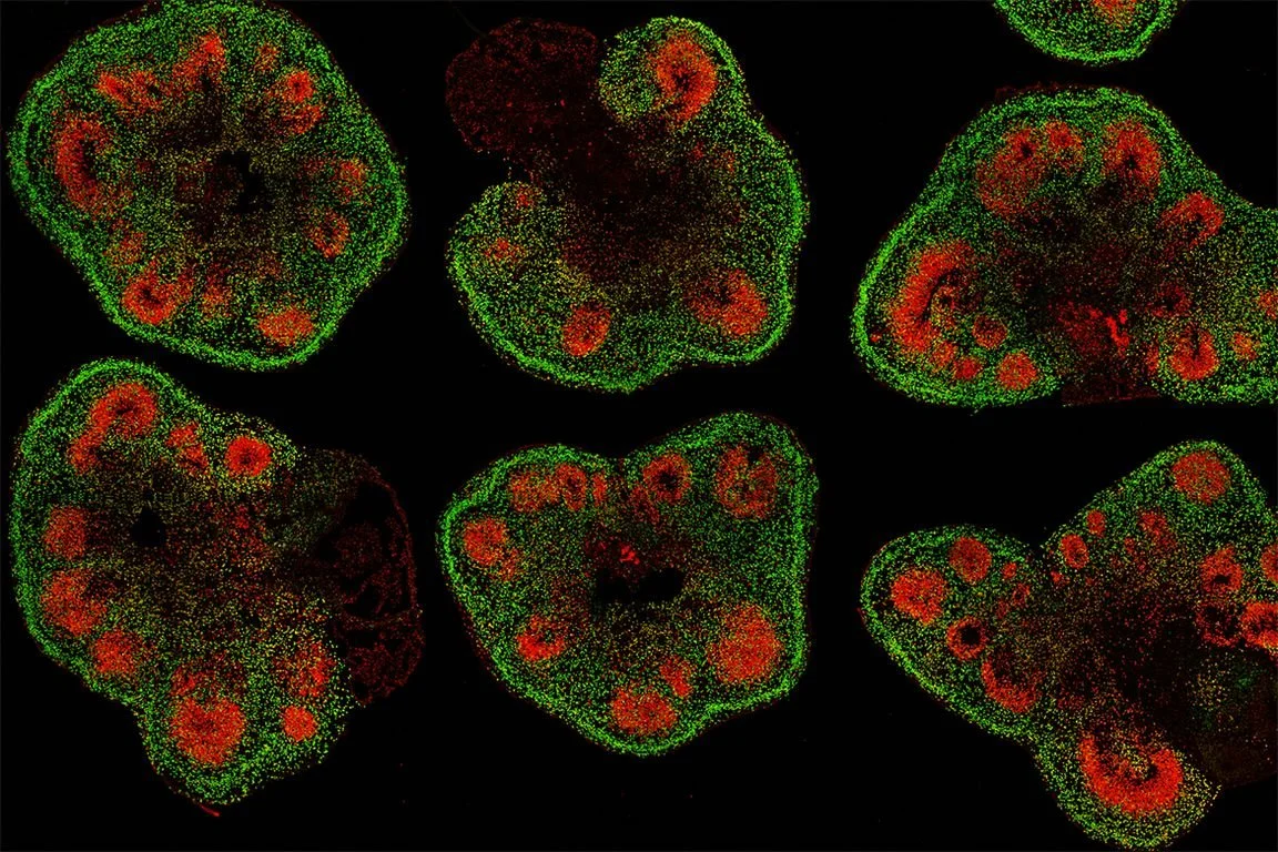 Imágenes microscópicas de secciones de organoides cerebrales cultivados en laboratorio, con células madre neurales en rojo y neuronas corticales en verde. Estas estructuras reproducen algunas características del cerebro humano.
