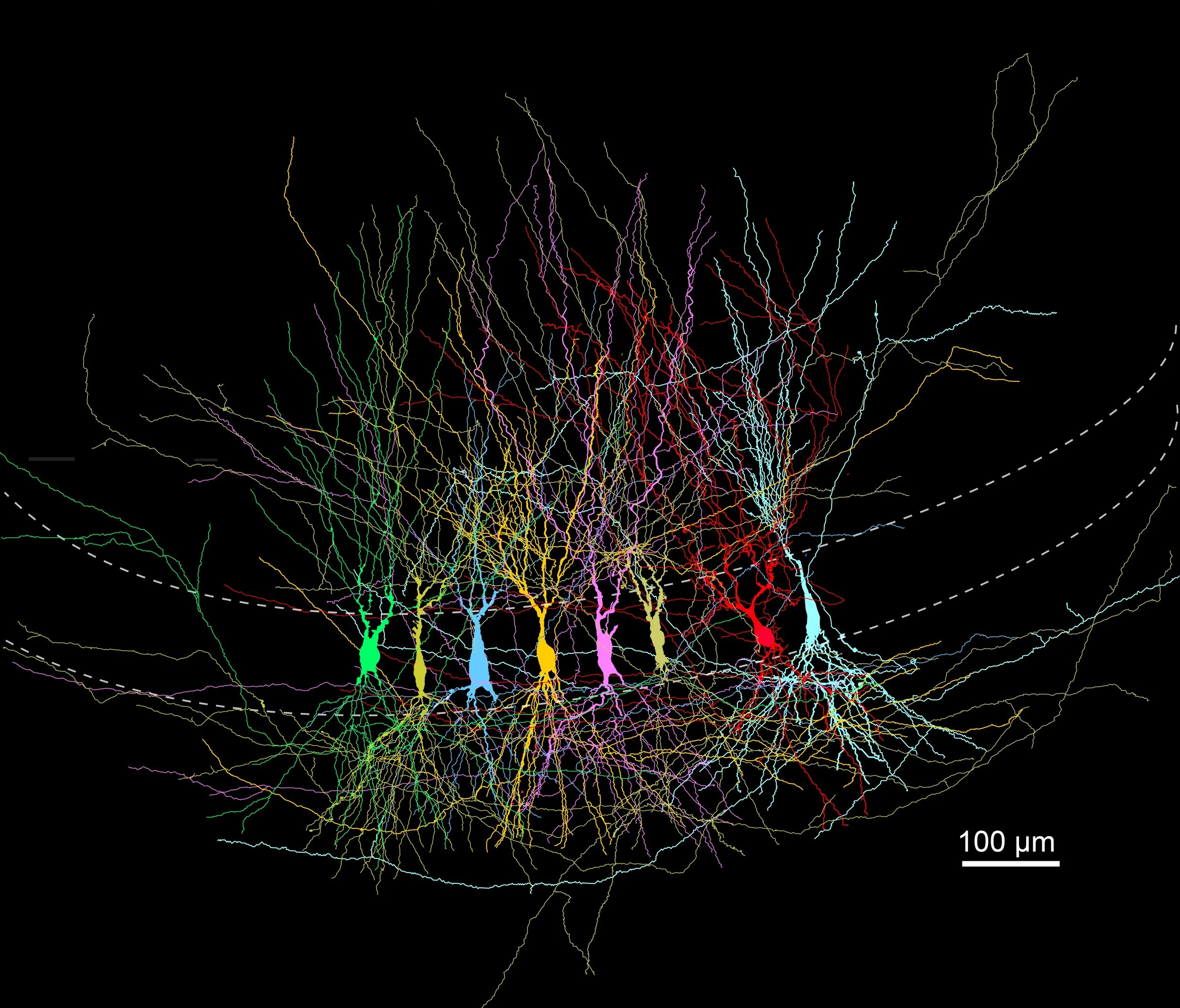 Neuronálmente etiquetadas con biocitina —un trazador que las marca durante el registro—, estas células son posteriormente fijadas y teñidas para reconstruir con precisión la compleja arquitectura de sus ramificaciones.