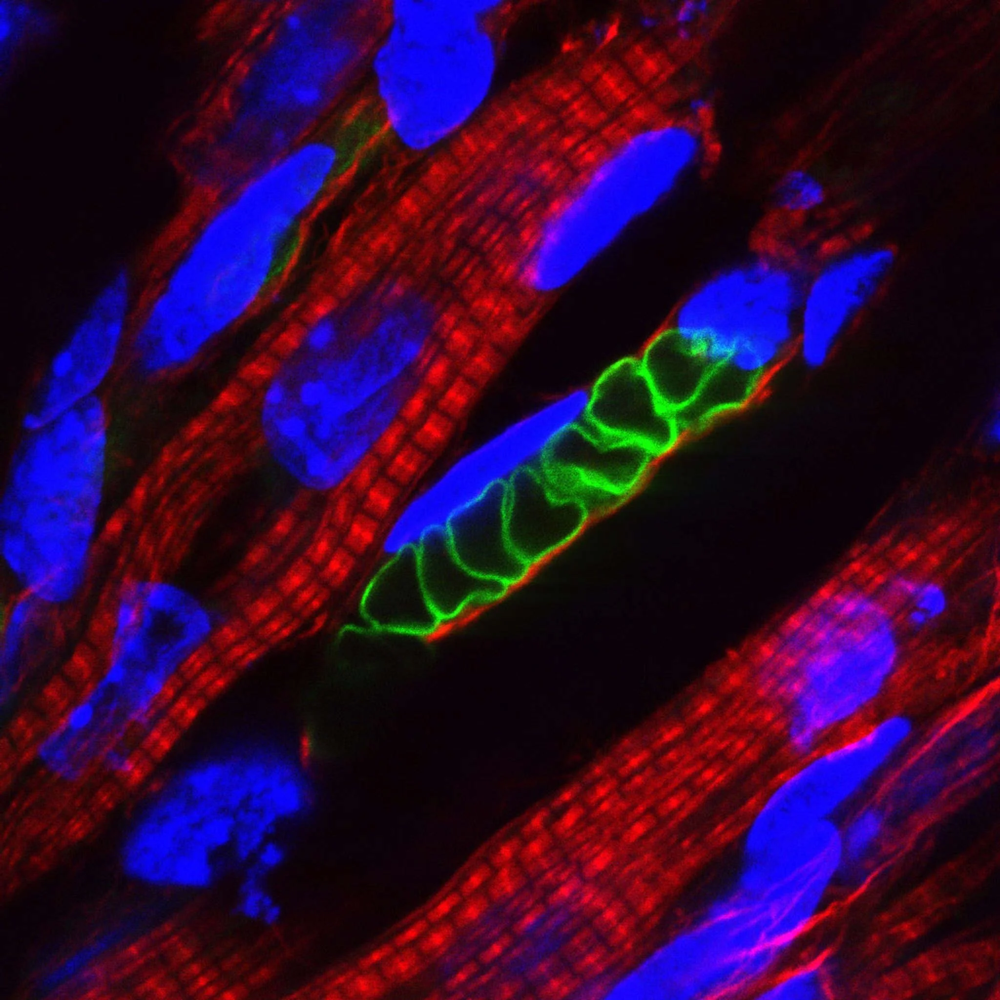 Imagen de inmunofluorescencia de músculo esquelético embrionario de ratón. En verde se observa una célula muscular en desarrollo, rodeada por fibras musculares (rojo) y núcleos celulares (azul).