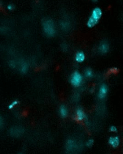 Reconstrucción tridimensional de un astrocito multinucleado situado junto a una lesión cerebral, observado in vivo 30 días después del daño.