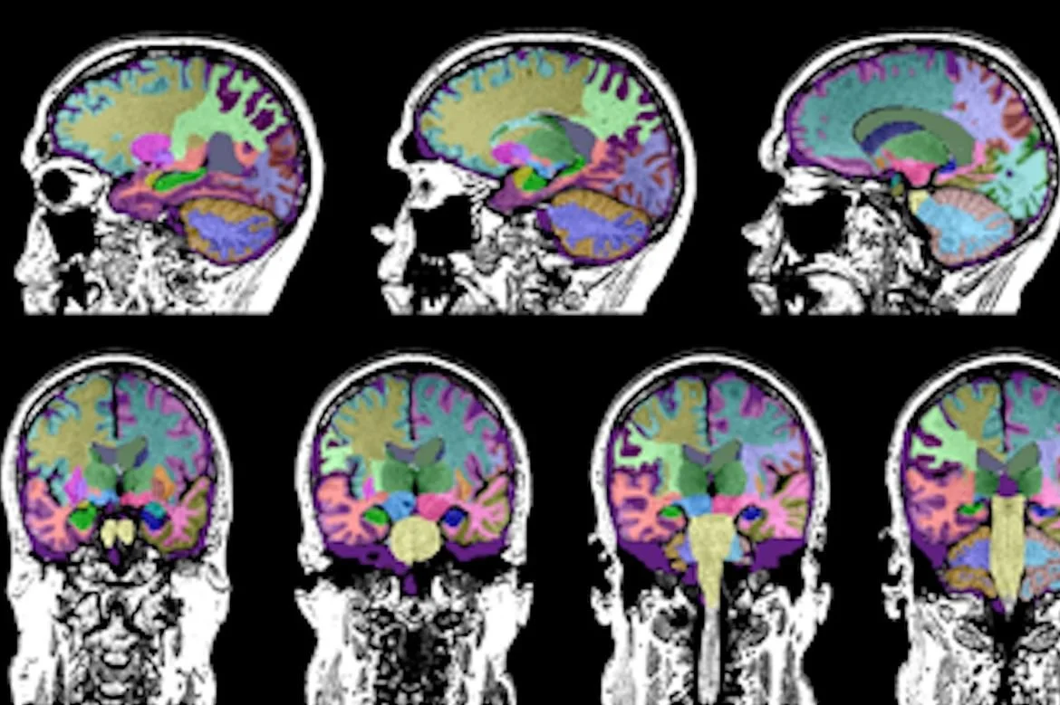 La investigación se centró en la corteza retrosplenial, una pequeña región situada en la parte posterior e interna del cerebro que mantiene una estrecha conexión con el hipocampo.