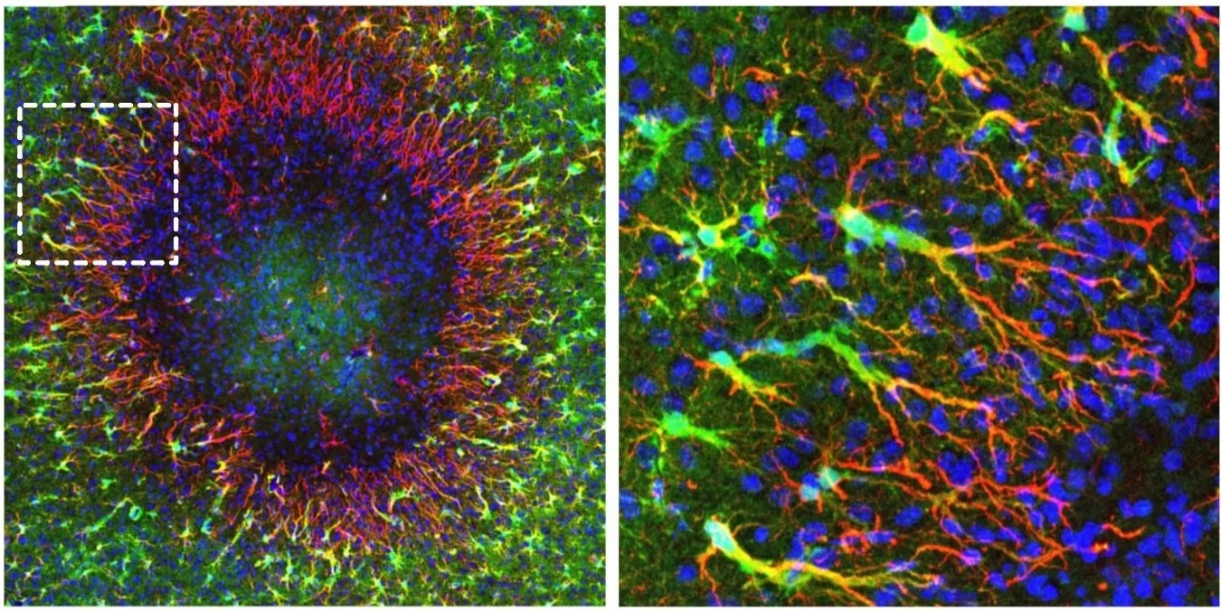 Imagen de una lesión cerebral de menos de 0,5 milímetros de diámetro rodeada por los recién identificados astrocitos regenerativos.