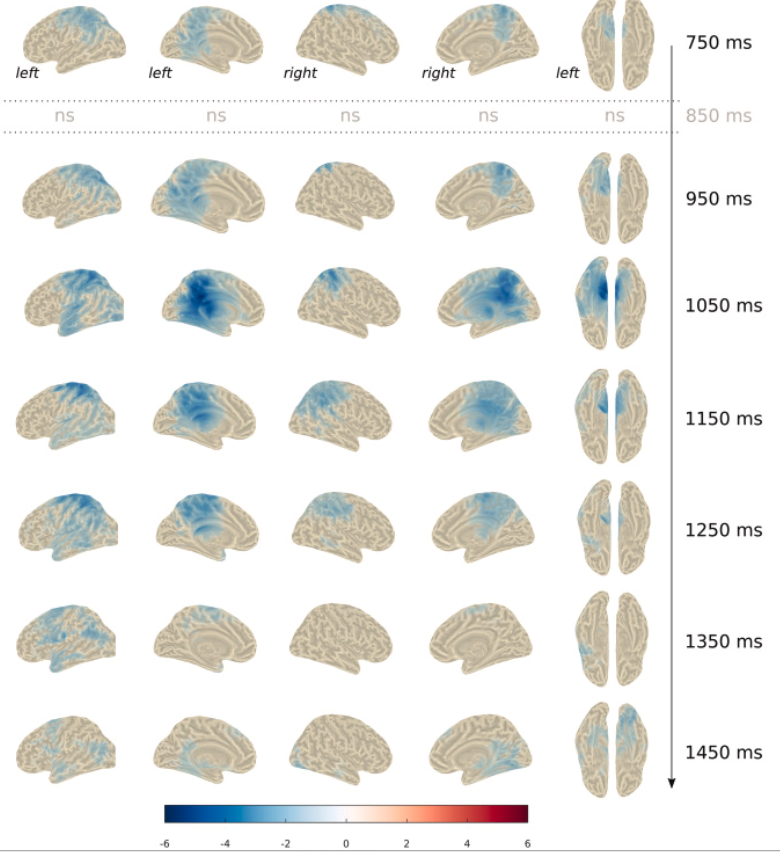 Actividad cerebral durante el recuerdo: las zonas en azul muestran áreas del cerebro que se activan de forma más eficiente cuando una persona recuerda correctamente.