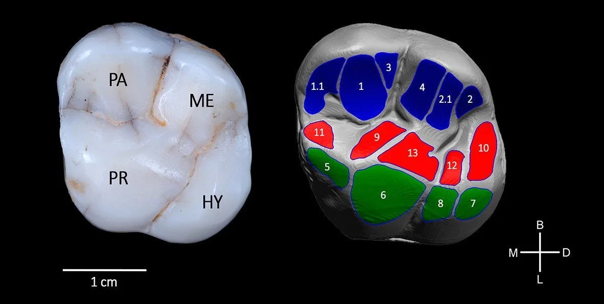 Molar superior de un individuo de la Sima de los Huesos (AT-3177): a la izquierda, el fósil original; a la derecha, el modelo 3D que revela las áreas de desgaste dental producidas durante la masticación.
