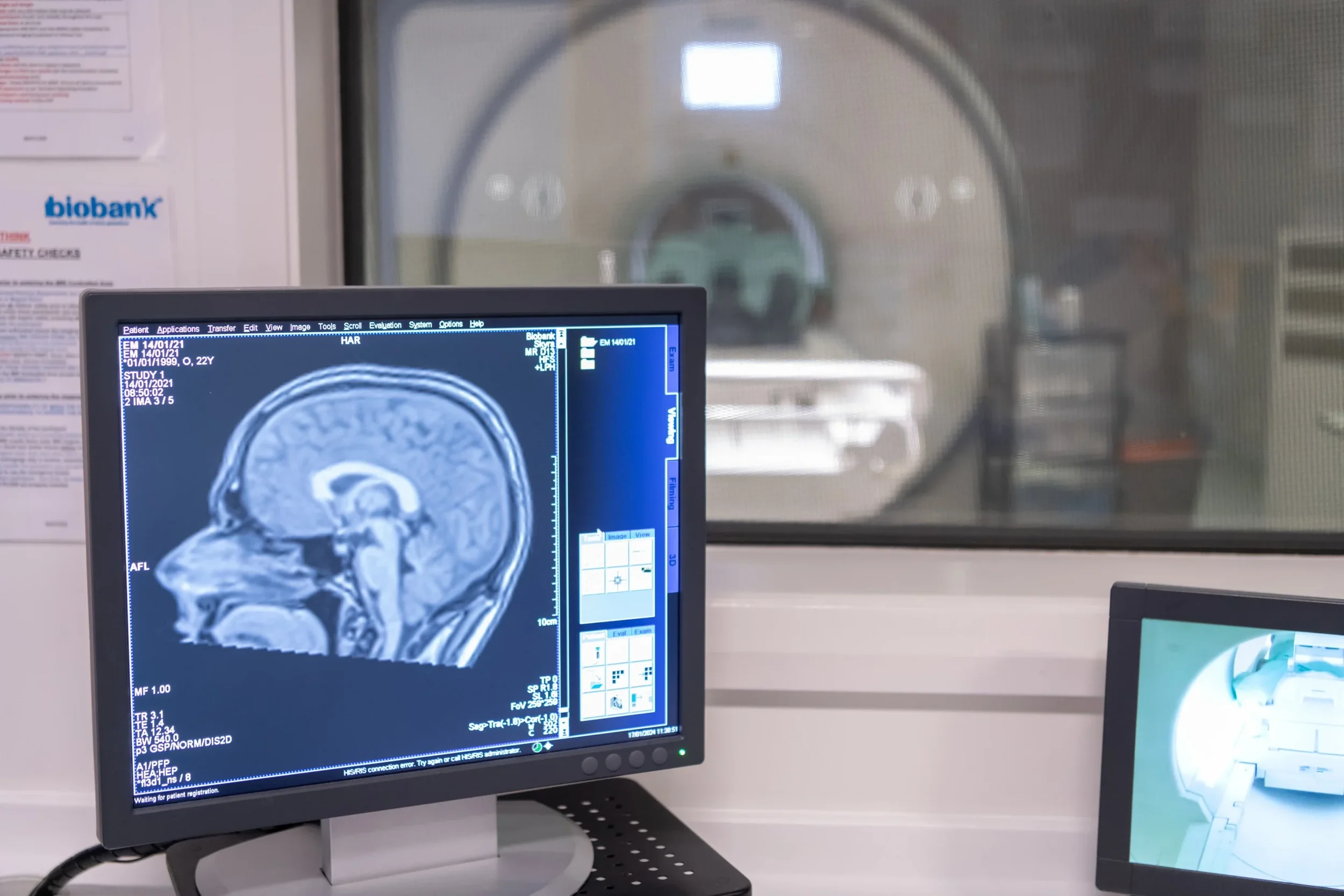Las técnicas de imagen como la resonancia magnética permiten detectar y localizar tumores cerebrales, pero determinar con precisión su subtipo suele requerir análisis histológicos y moleculares adicionales.