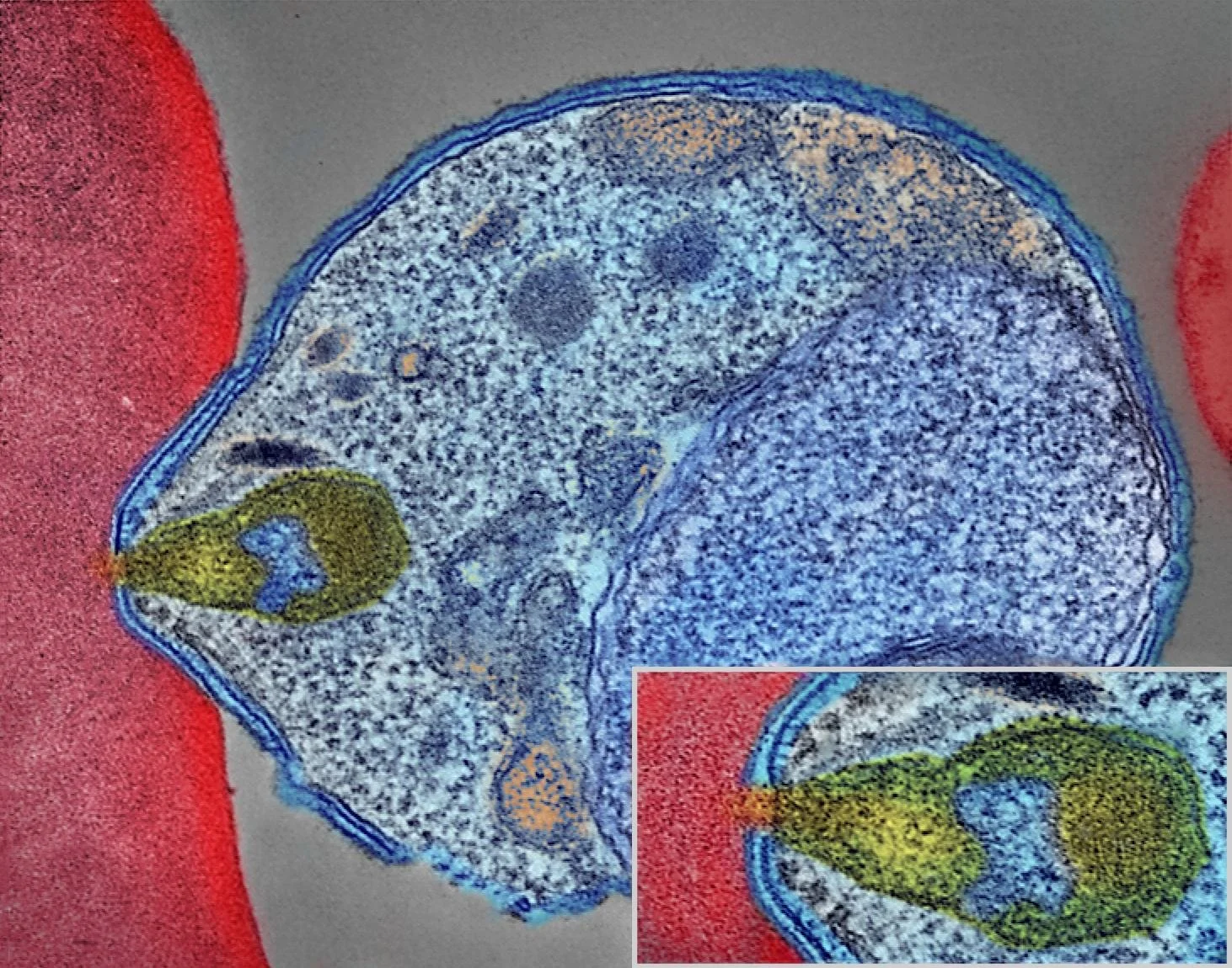 Micrografía electrónica coloreada que muestra el momento en que un parásito de la malaria (Plasmodium falciparum, en azul) se adhiere a un glóbulo rojo humano (en rojo) para iniciar la invasión de la célula.