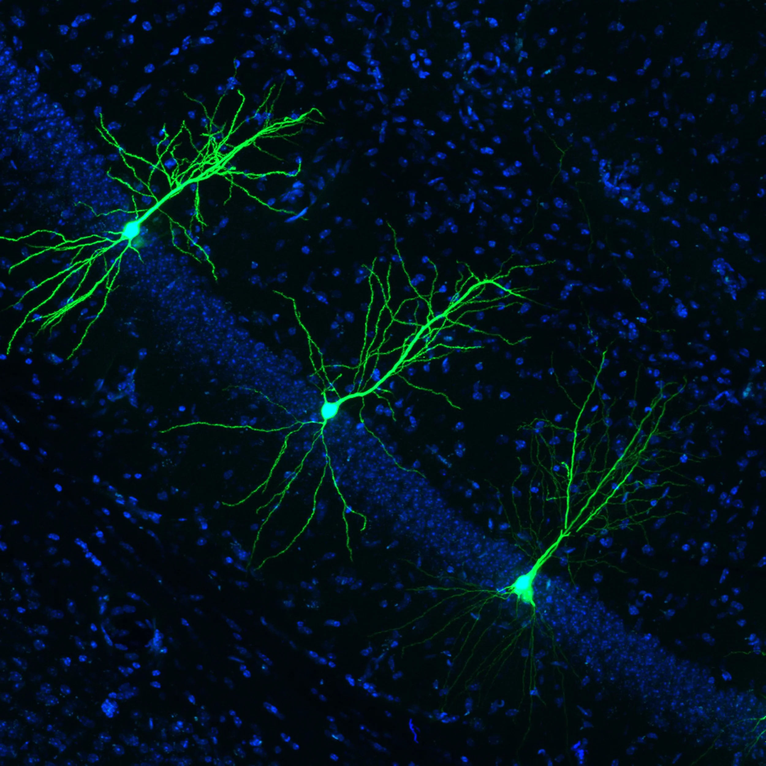 La inhibición de la enzima LIMK1 parece aumentar la longitud y la densidad de las espinas dendríticas, visualizadas en verde.