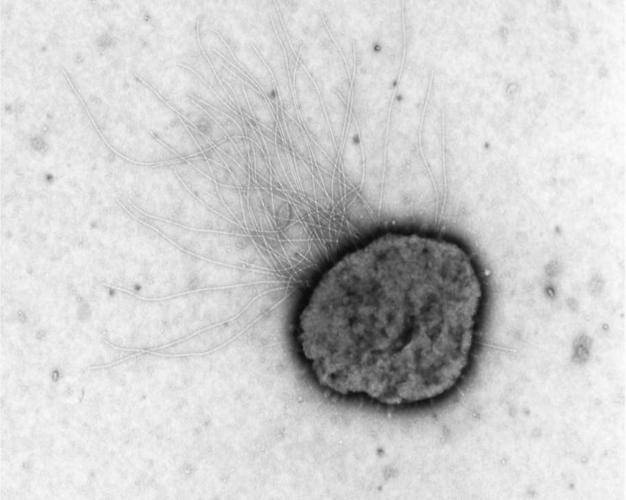 Micrografía electrónica de Methanococcus maripaludis, una arquea metanógena capaz de producir metano utilizando hidrógeno y dióxido de carbono.