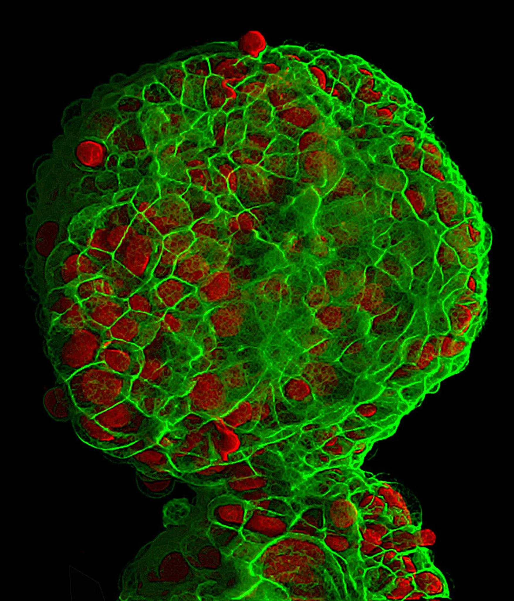 Imagen tridimensional de células de cáncer de mama cultivadas en laboratorio: en verde, la estructura celular; en rojo, núcleos o células en proliferación.