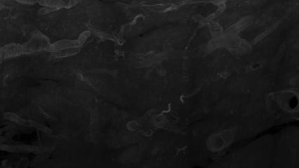 Animación tridimensional de una región de un páncreas afectado por diabetes de tipo 1 de inicio tardío.