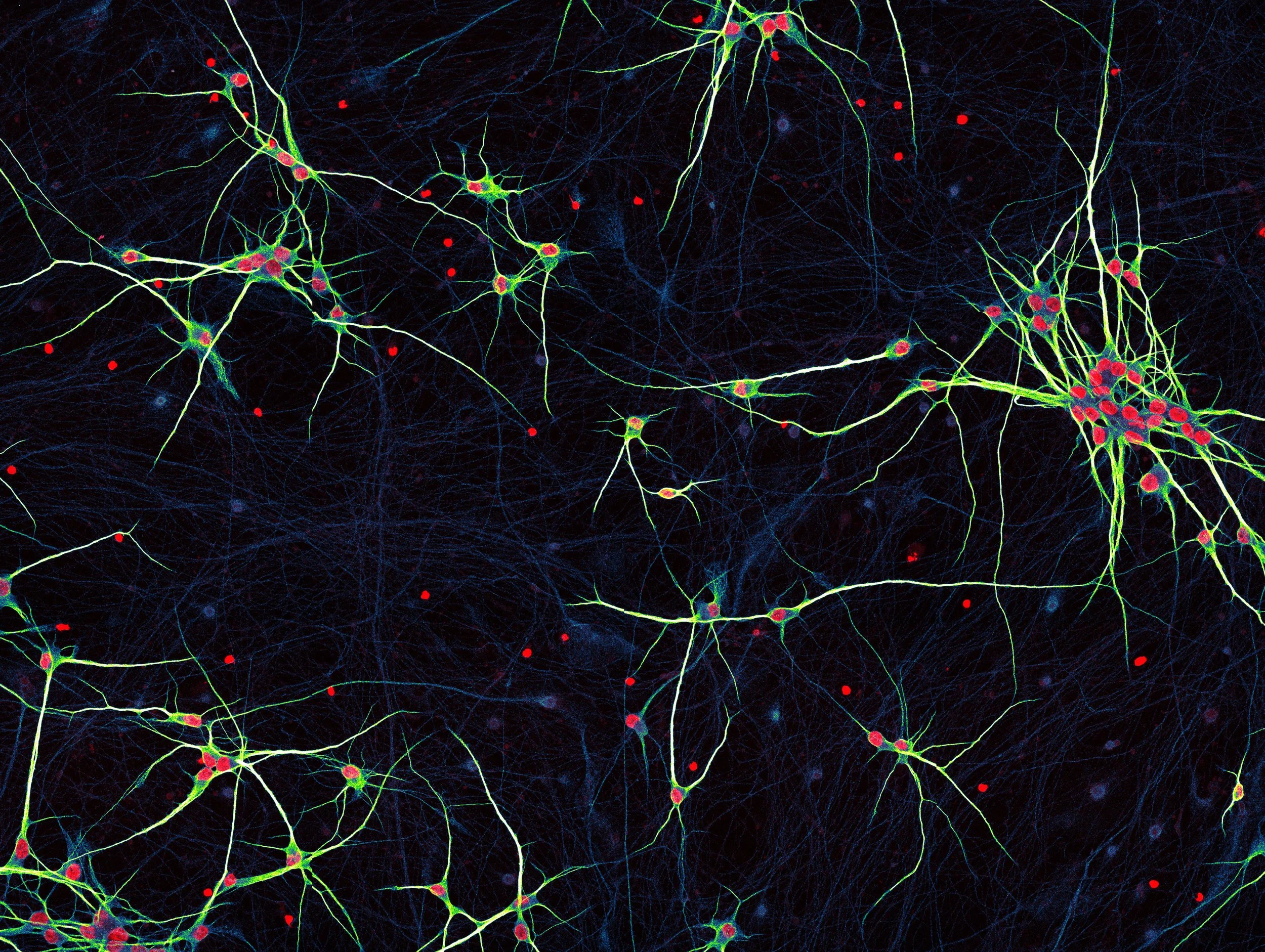 La teoría de cuerdas puede ayuda a los neurólogos a conocer con mayor profundidad cómo se ramifican las neuronas humanas.