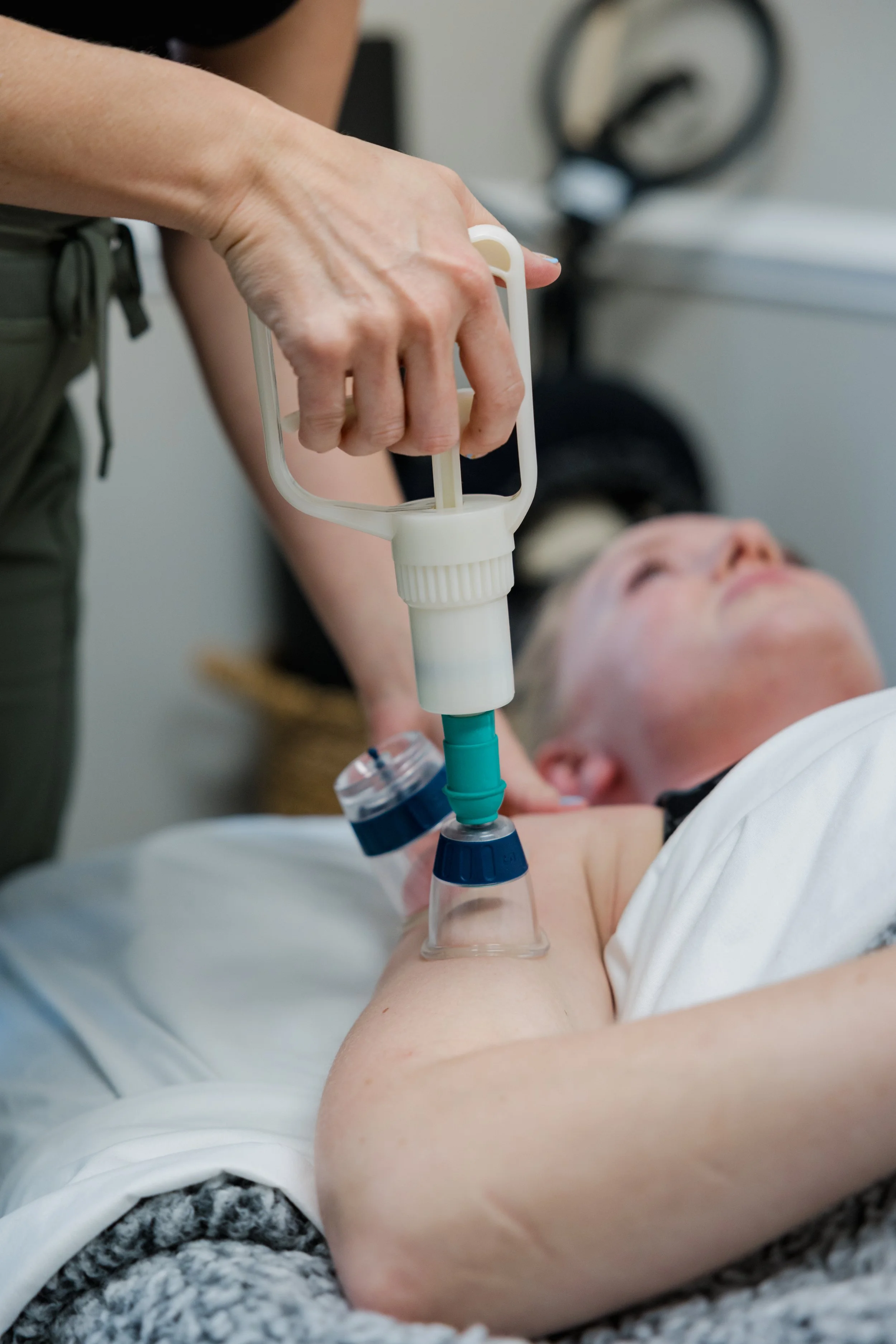 Woman receiving cupping treatment