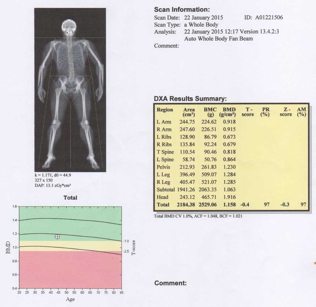 Interpreting Your DEXA — VITALITY