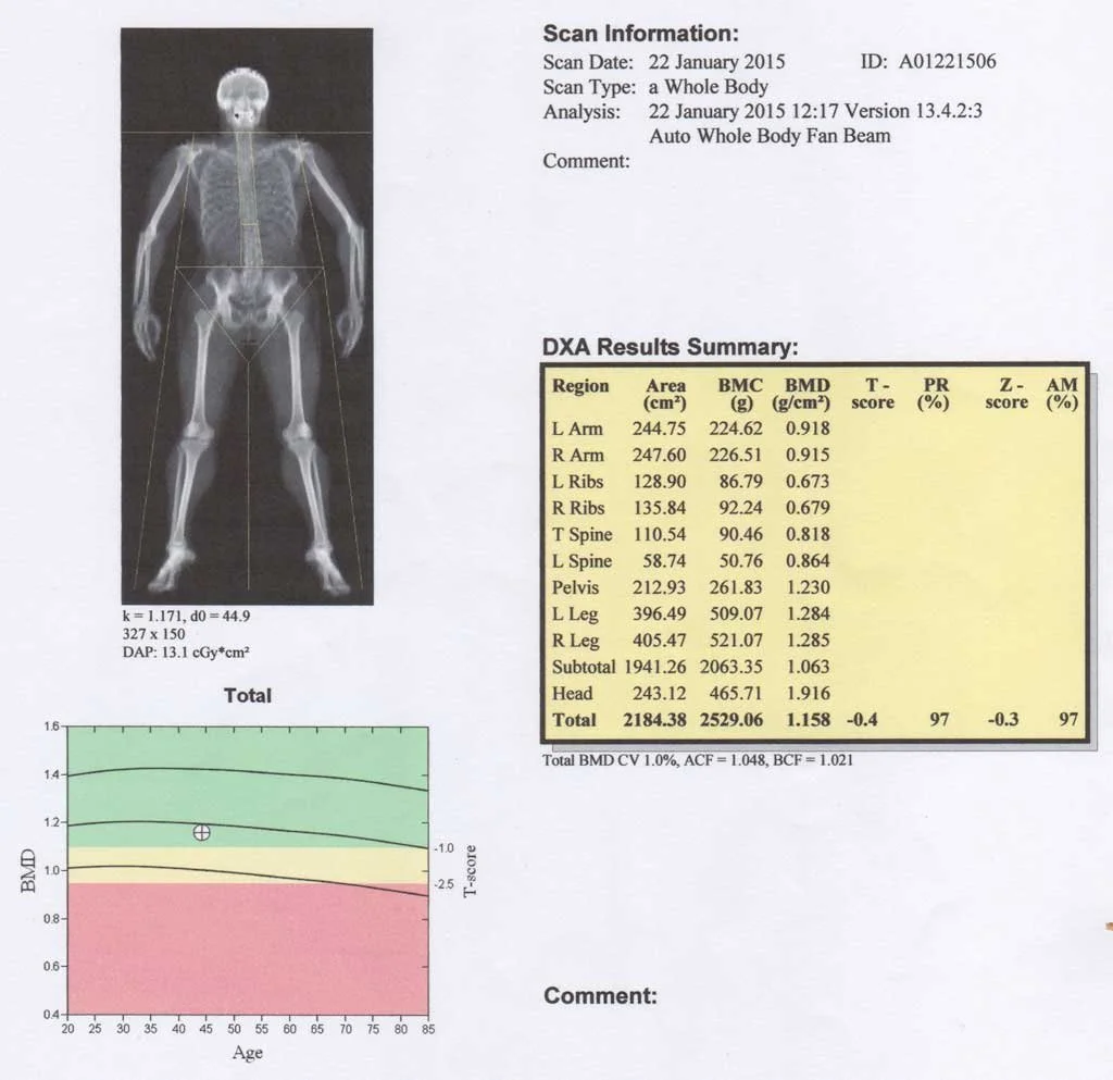 Interpreting Your DEXA — VITALITY