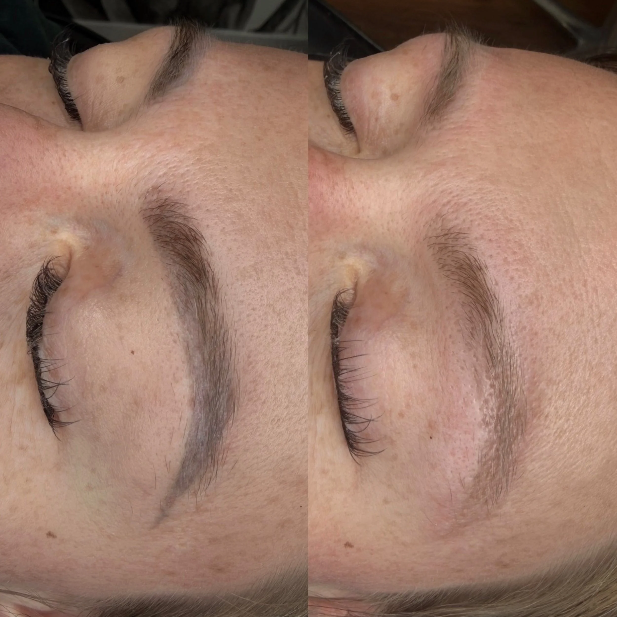 bloom-beauty-studio-toronto-permanent-make-up-laser-removal-3.jpg