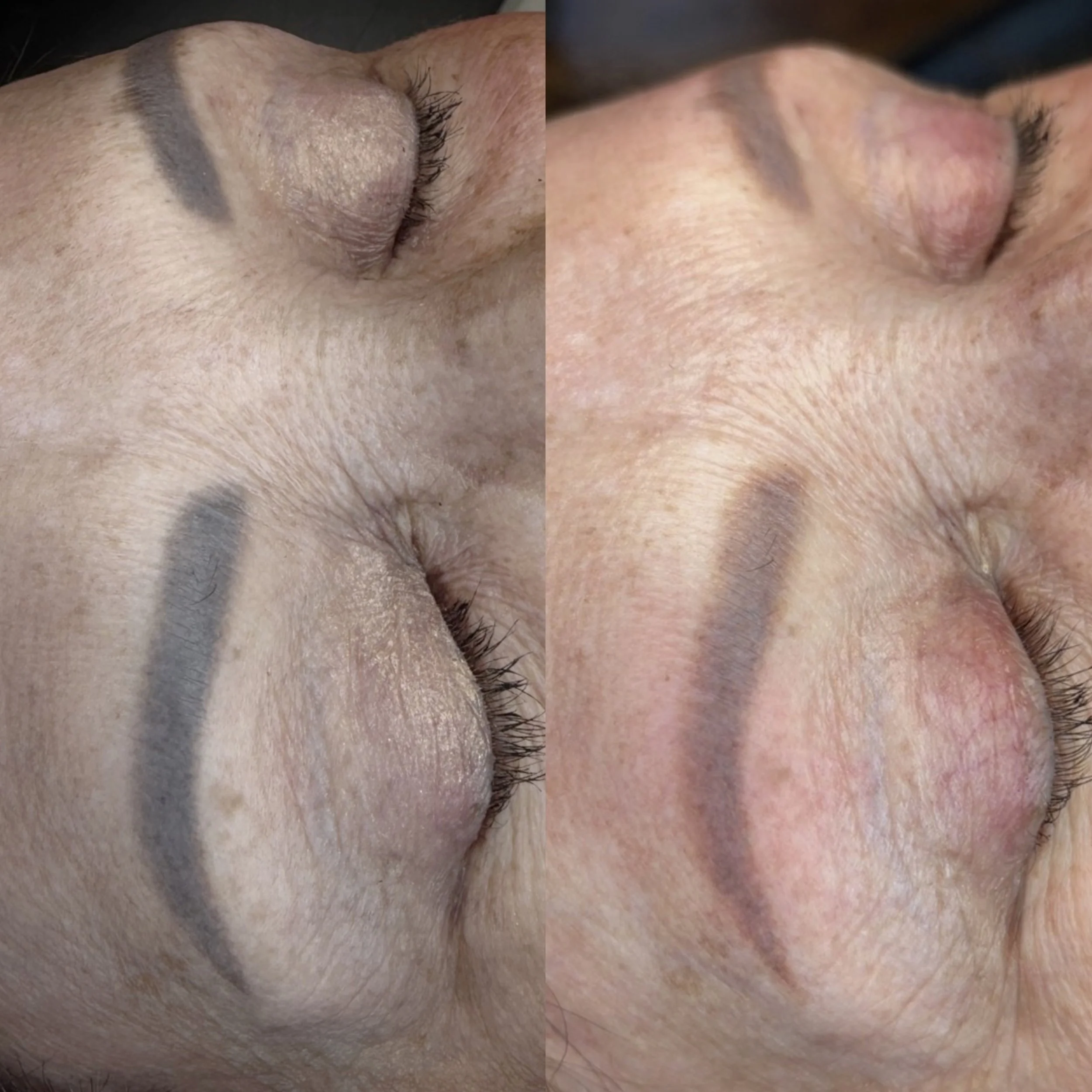 bloom-beauty-studio-toronto-permanent-make-up-laser-removal-4.jpg