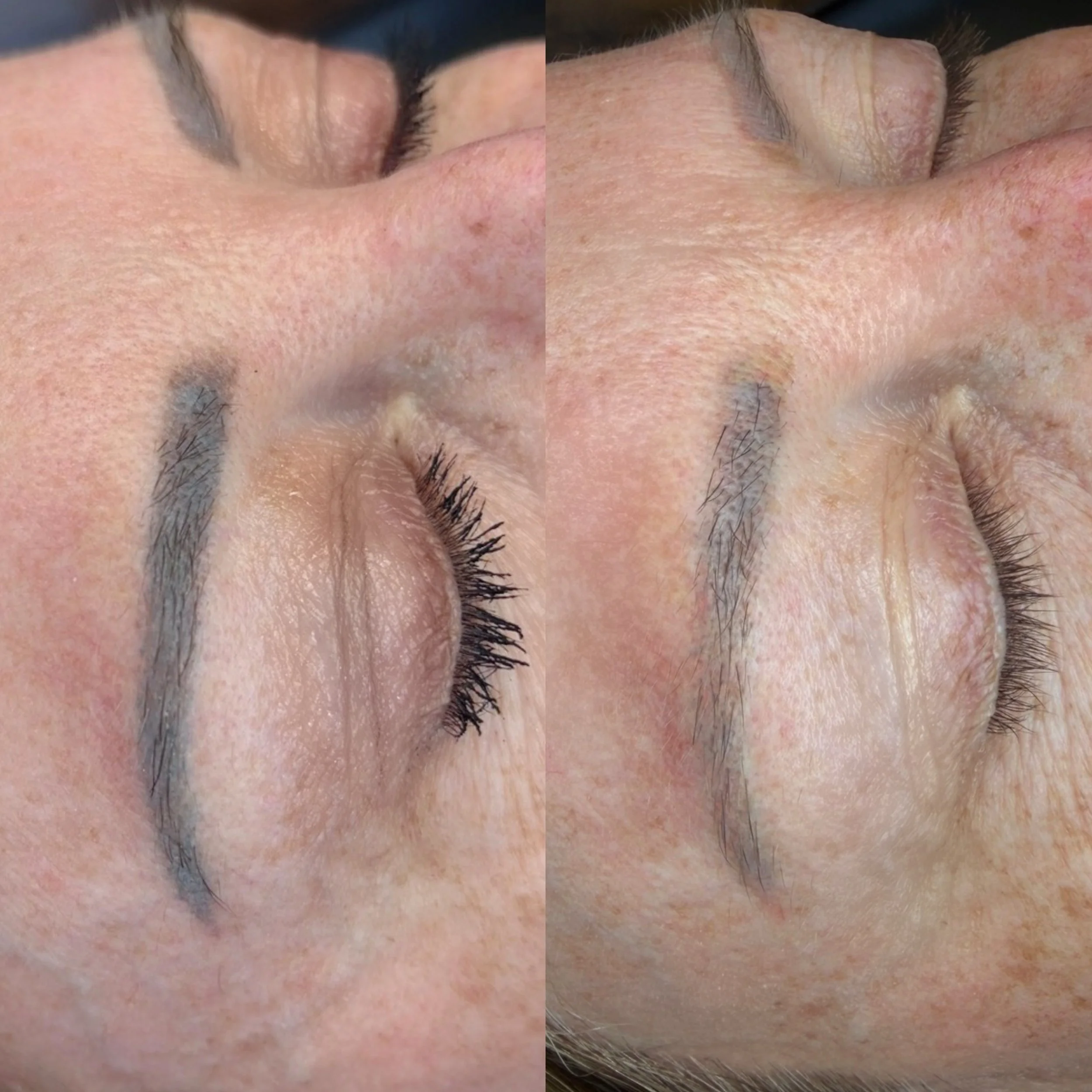 bloom-beauty-studio-toronto-permanent-make-up-laser-removal-6.jpg