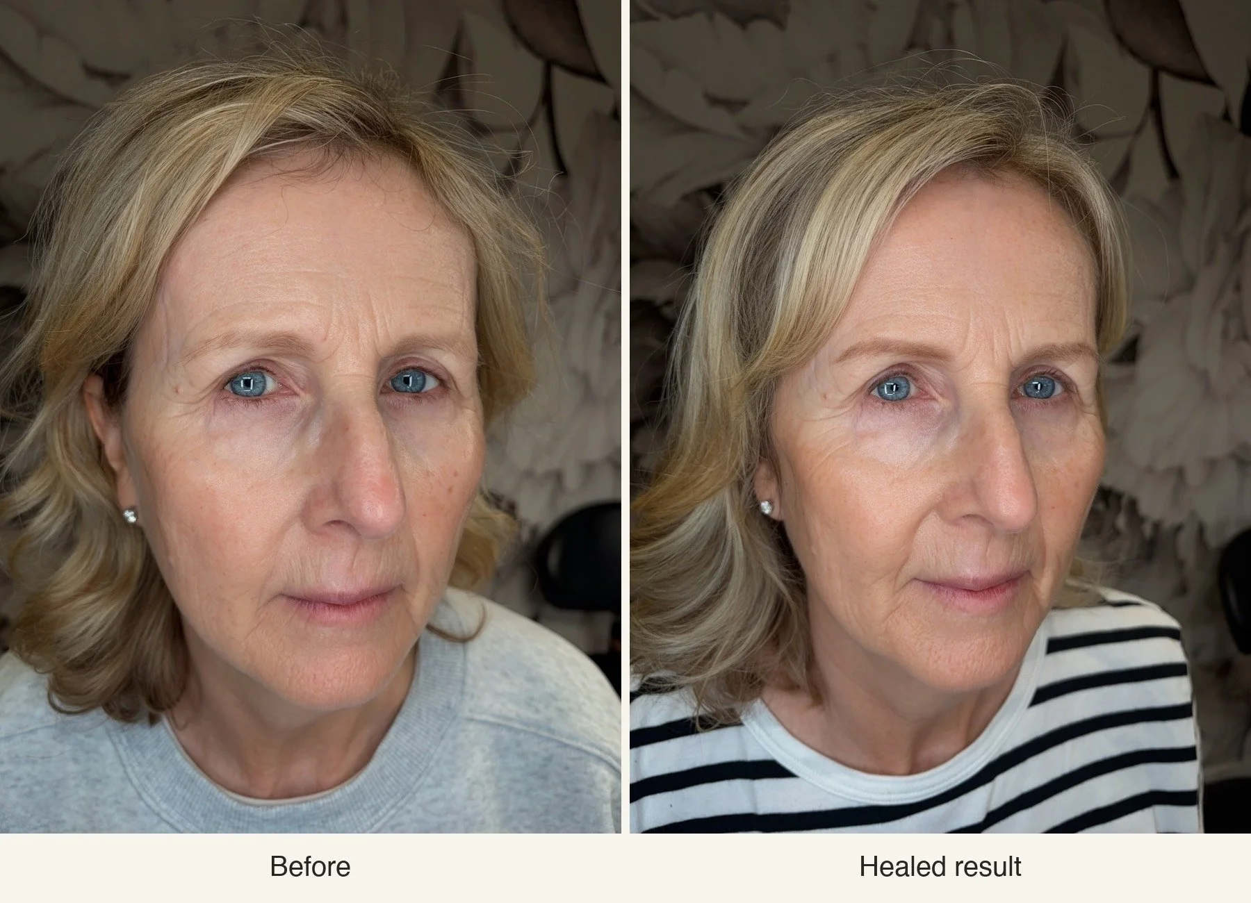 Before and healed brow results on the same mature client: sparse brows on the left and soft, fuller definition on the right.