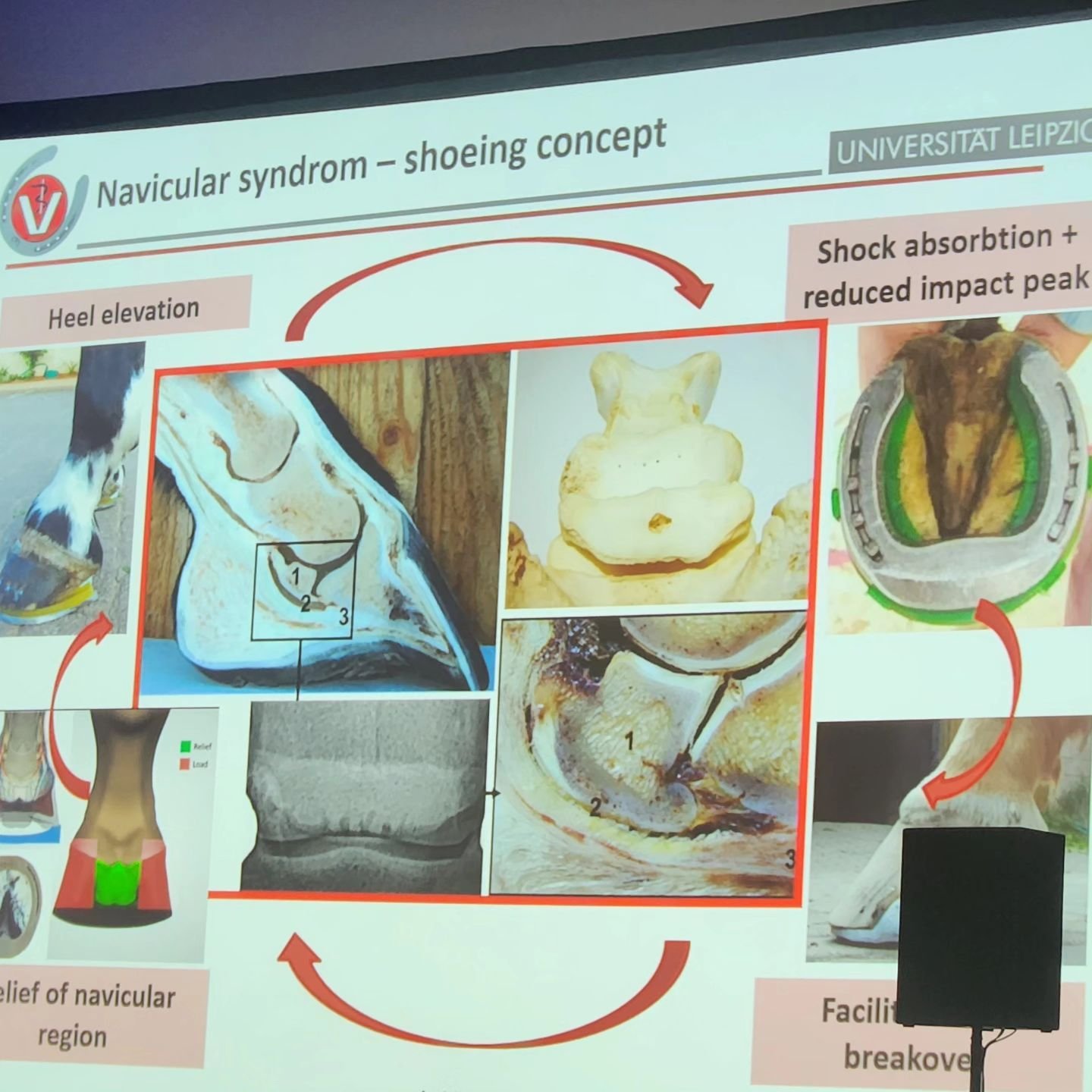 At the 2023 American Association of Equine Practitioners meeting, shoeing modifications for Navicular Disease were discussed. These include raised heels, easy breakover and soft pads. In this presentation slide, you can see the similar x-ray changes 