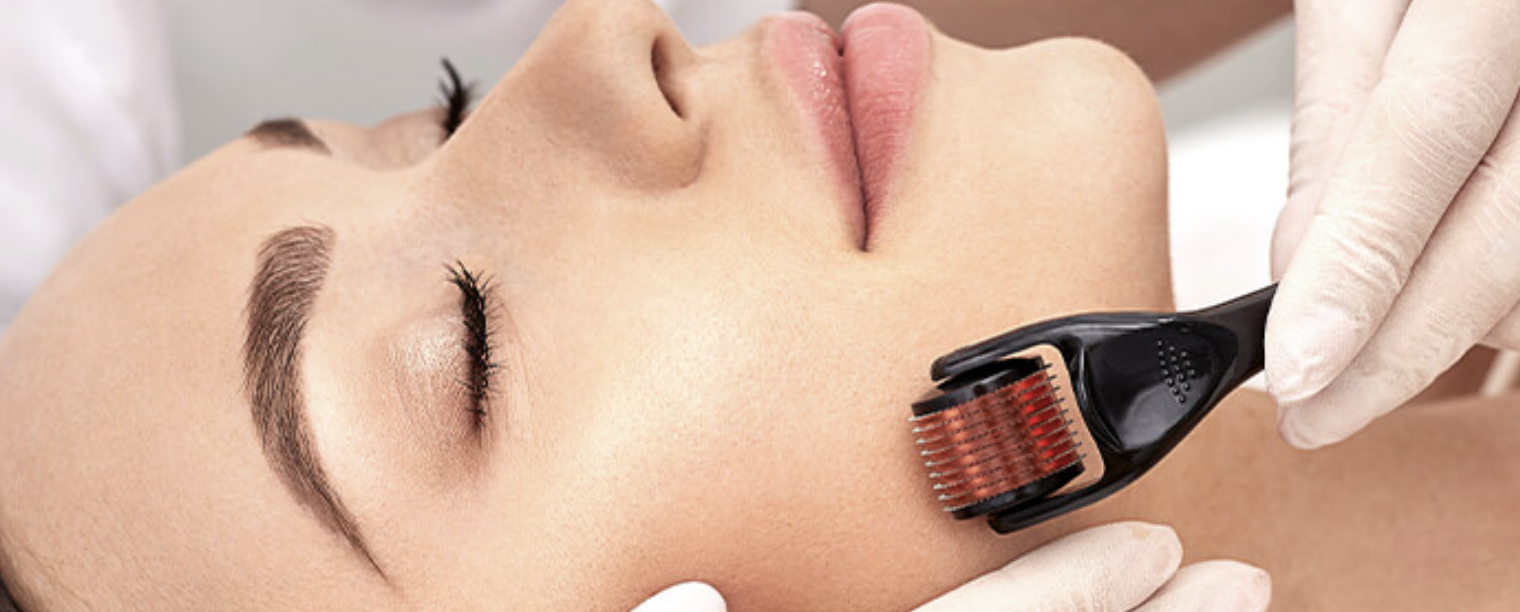 PRP Microneedling: The Ultimate Skin Rejuvenation Treatment in London
