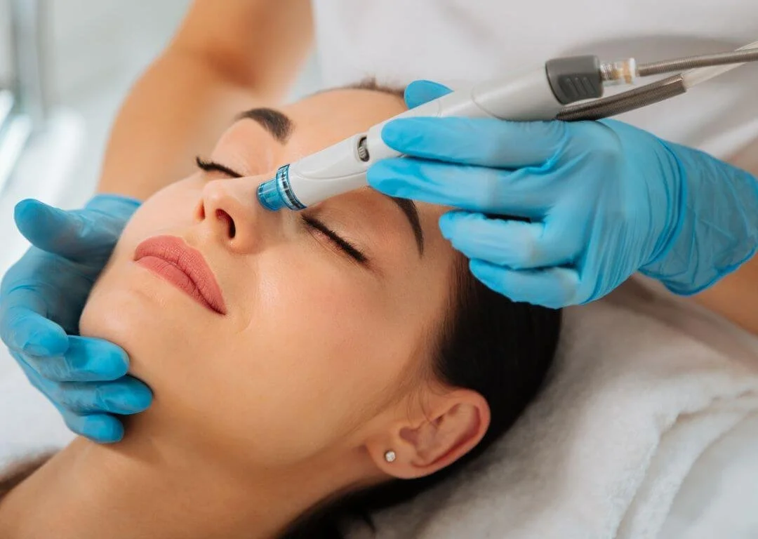 PRP and Microneedling: The Ultimate Combo for Glowing Skin