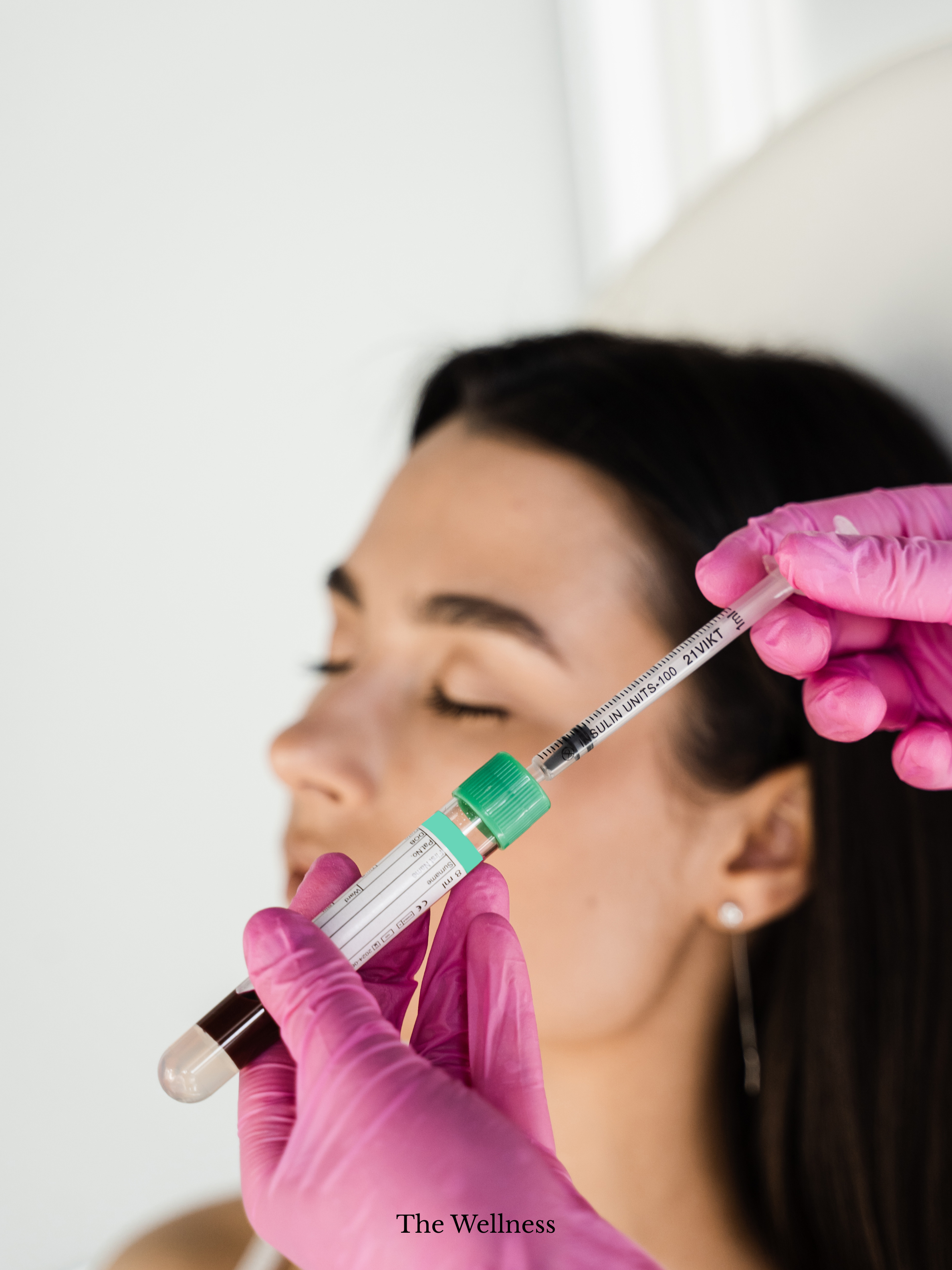 PRP Treatment Recovery Timeline - What to Expect Week by Week