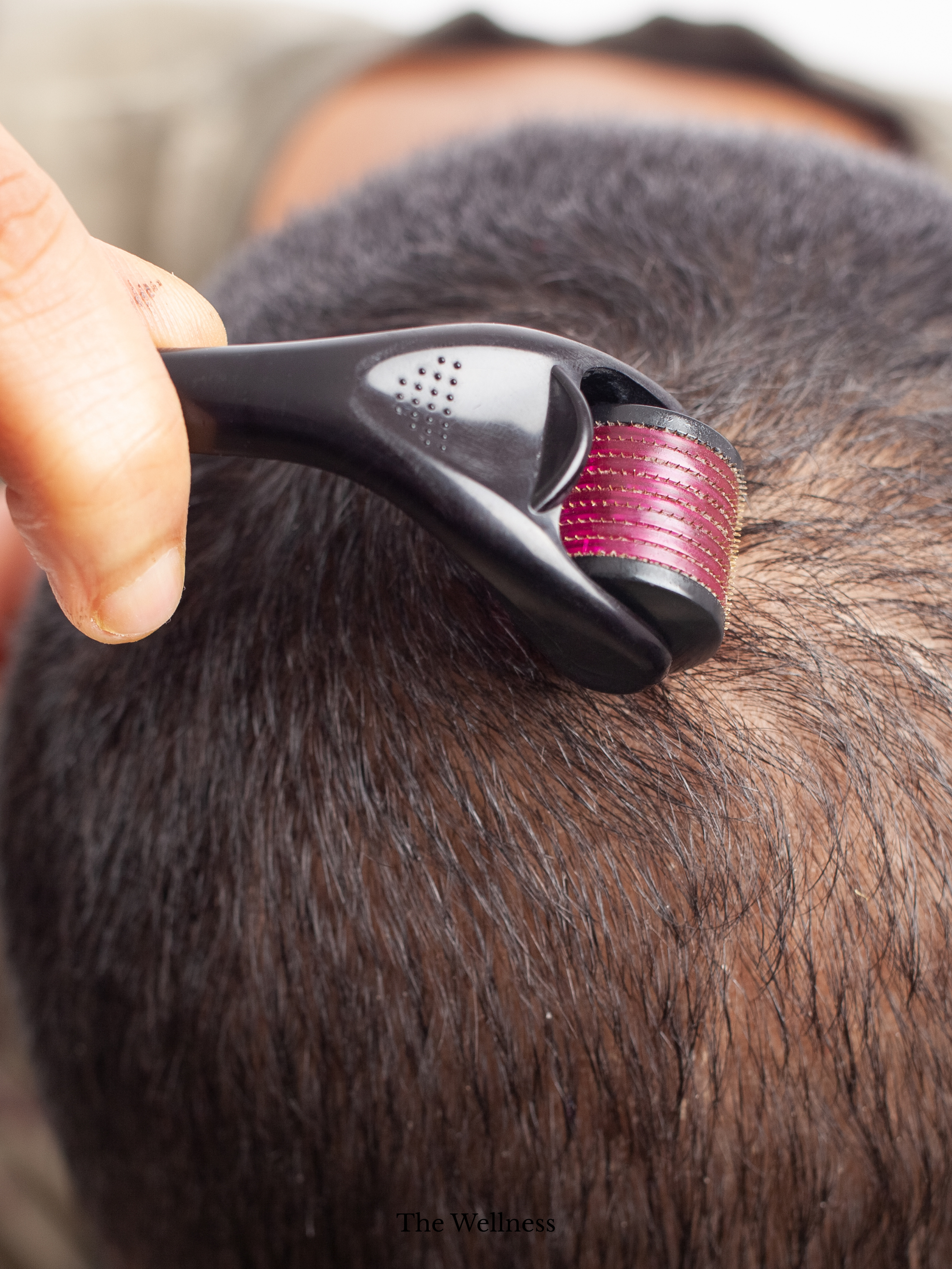 Can PRP Really Regrow Hair - Latest London Clinical Results 2025