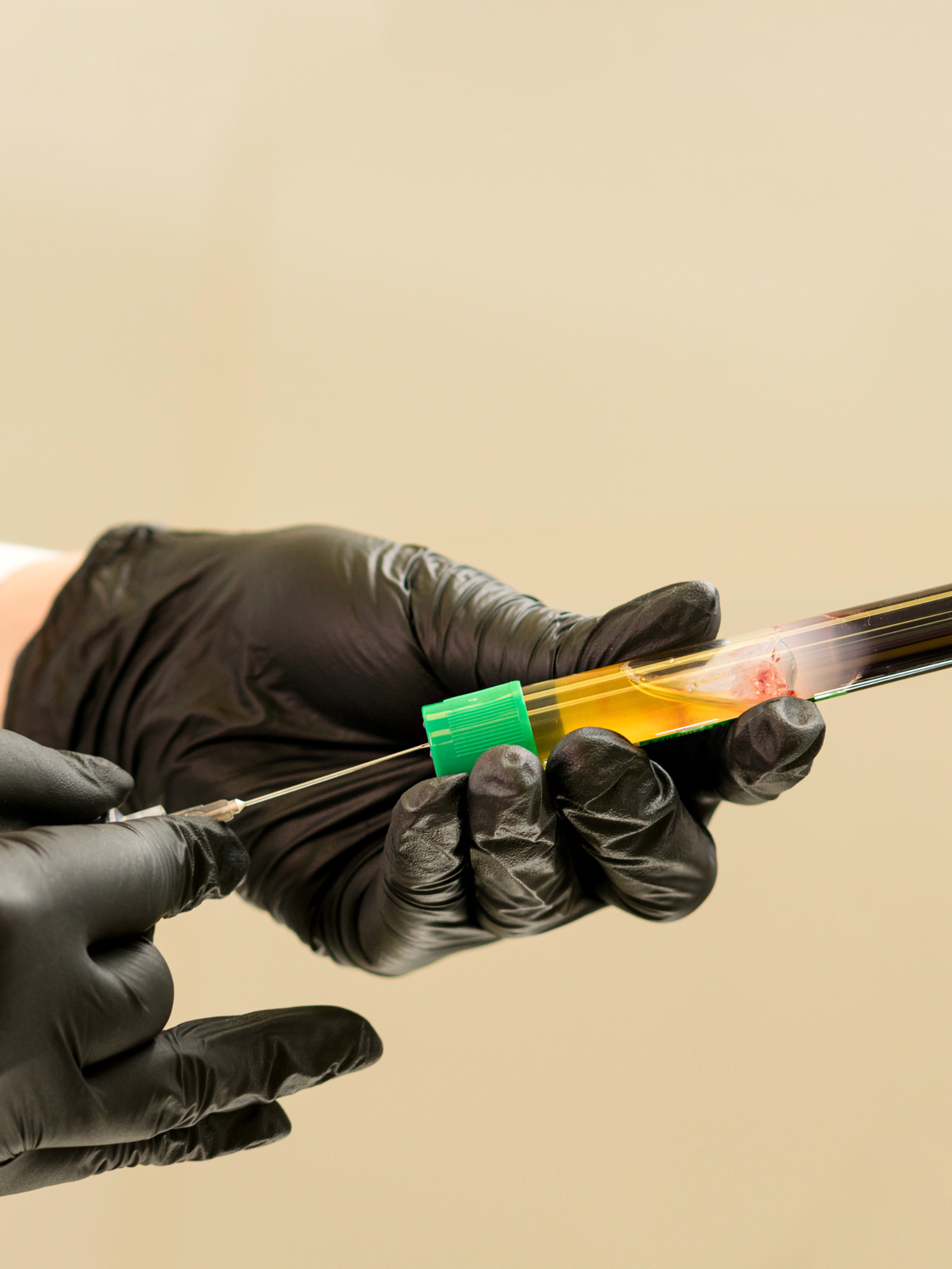 Combining PRP With Other Treatments for Best Results