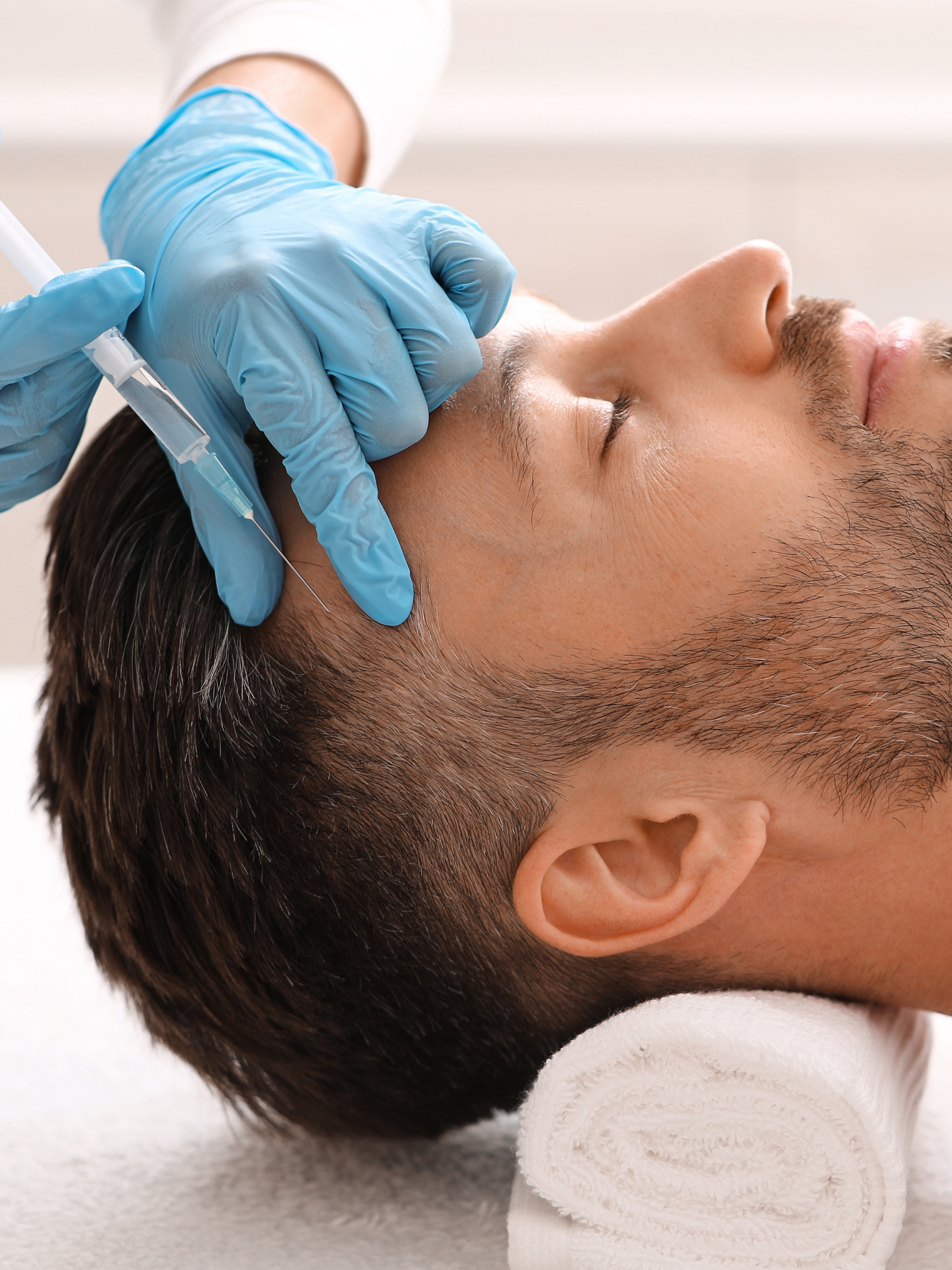 Is PRP Worth It for Hair Loss