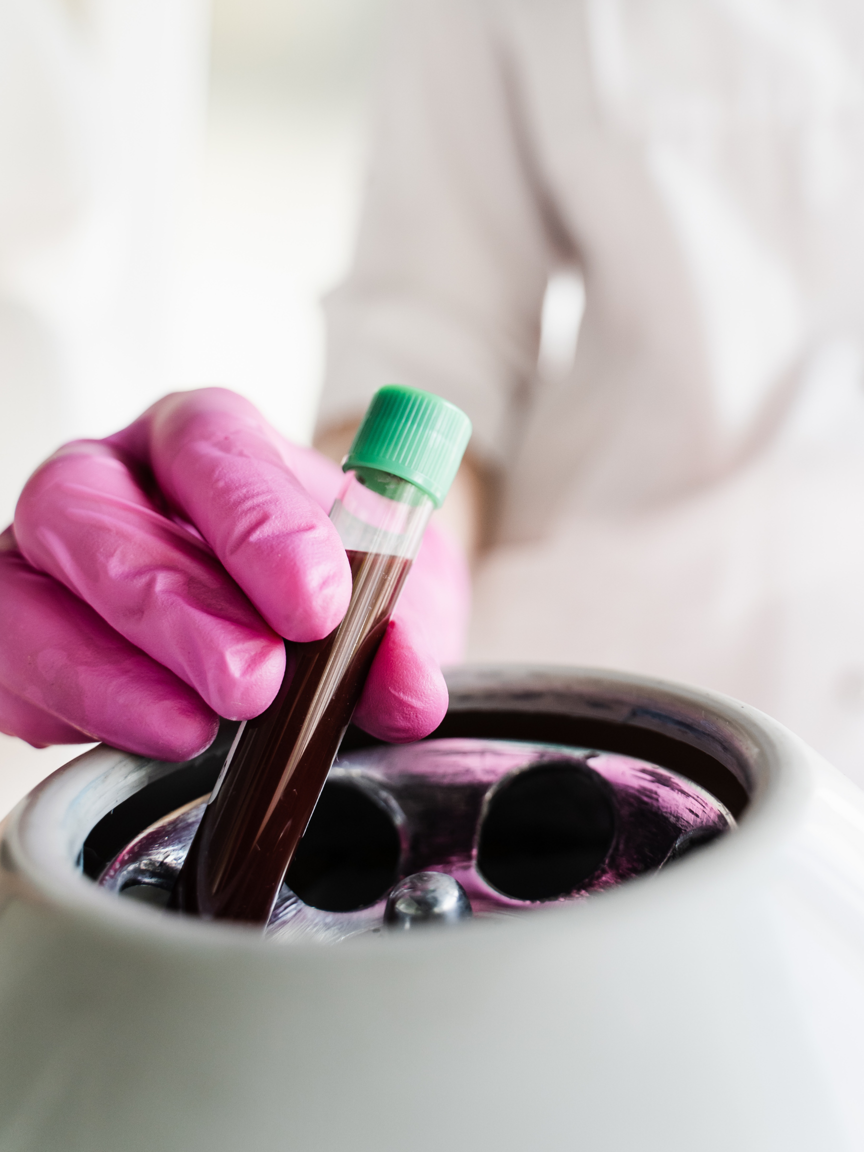 PRP Side Effects and Recovery: What to Expect After Your Treatment