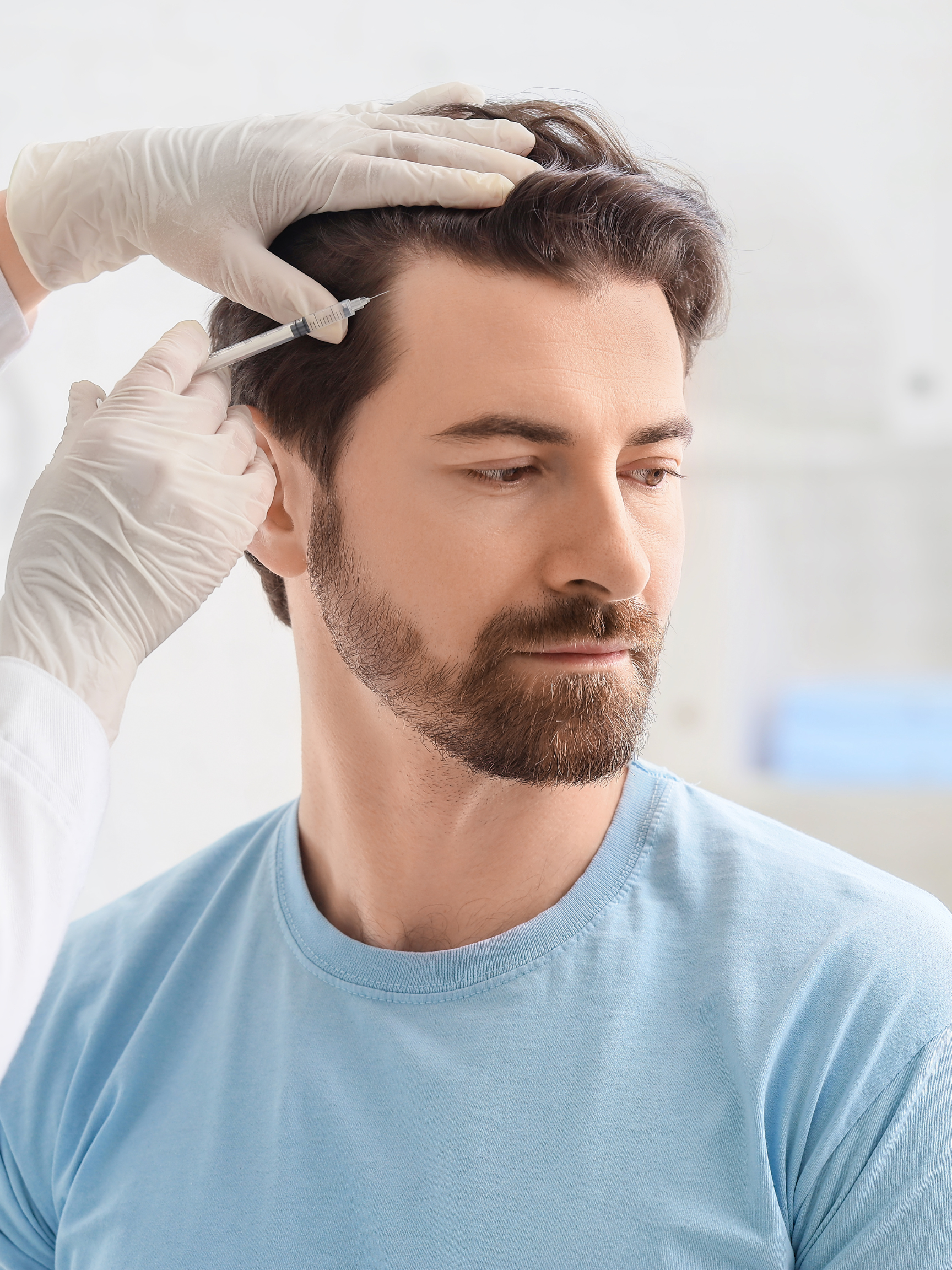 What Causes Hair Loss in Women: A Complete Guide to Female Hair Thinning