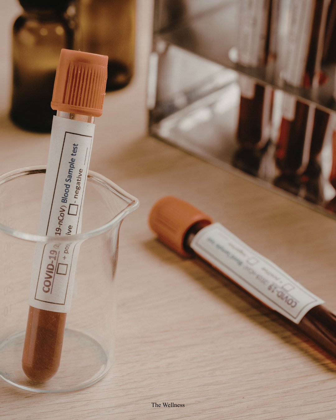 Hair Loss Blood Tests: Which Tests You Need and What the Results Actually Mean