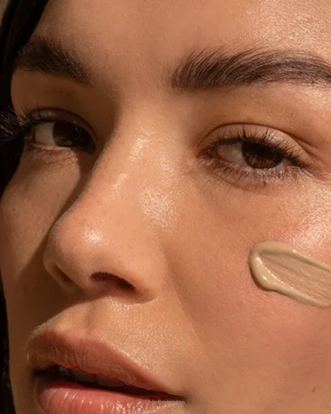 PRP for Acne Scars in London: The Natural Collagen-Rebuilding Treatment That Actually Works