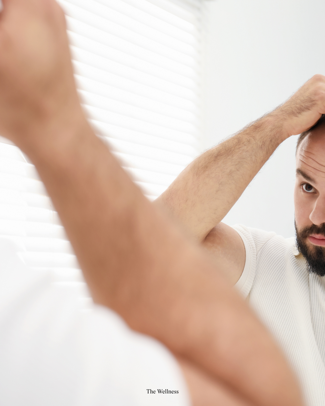 Receding Hairline: How to Stop It and What Actually Works (2026 Treatment Guide)